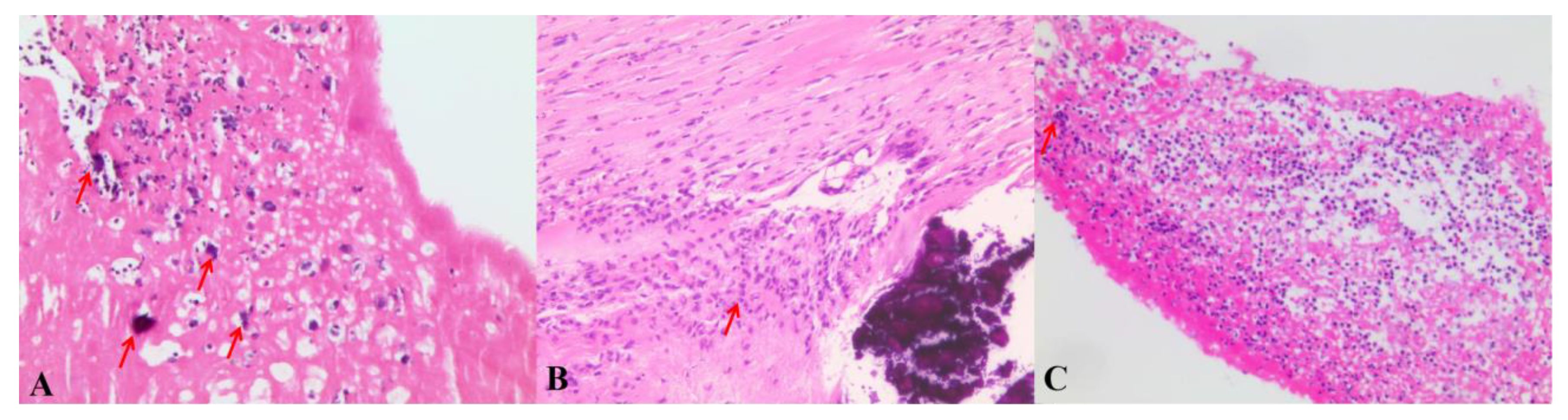 Jcm 11 07150 g004 Jcm 11 07150 g004