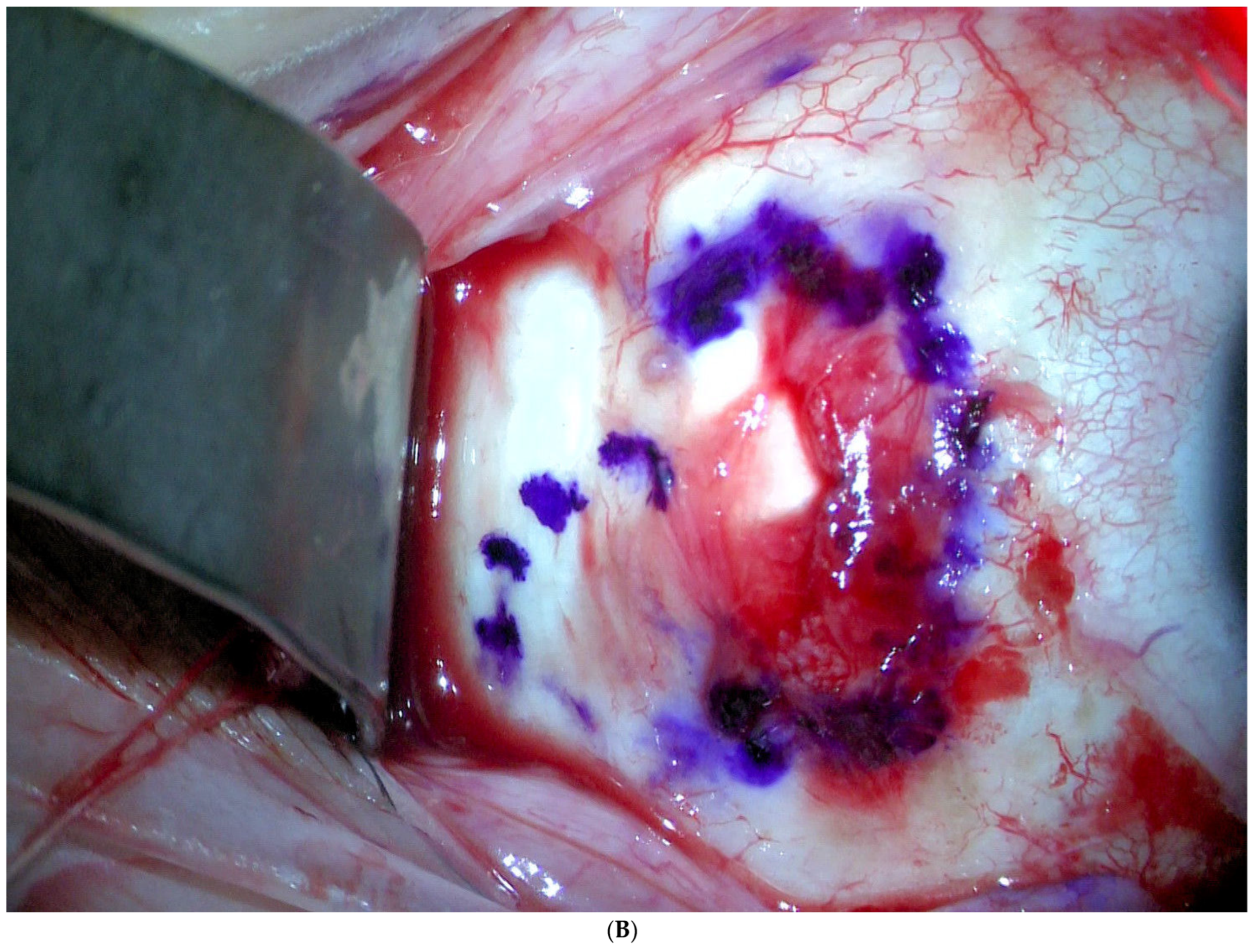 Jcm 11 07156 g001b Jcm 11 07156 g001b