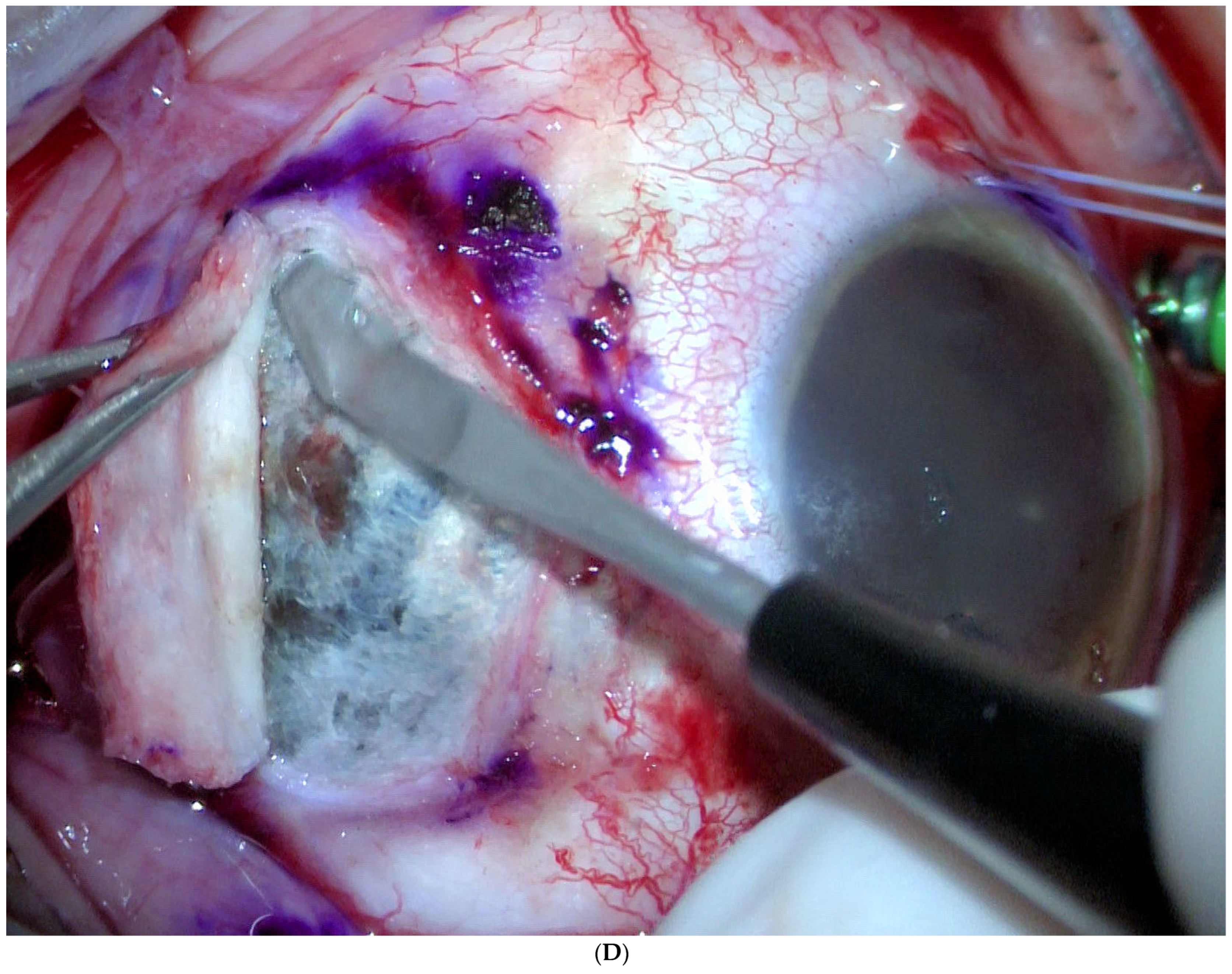 Jcm 11 07156 g001d Jcm 11 07156 g001d