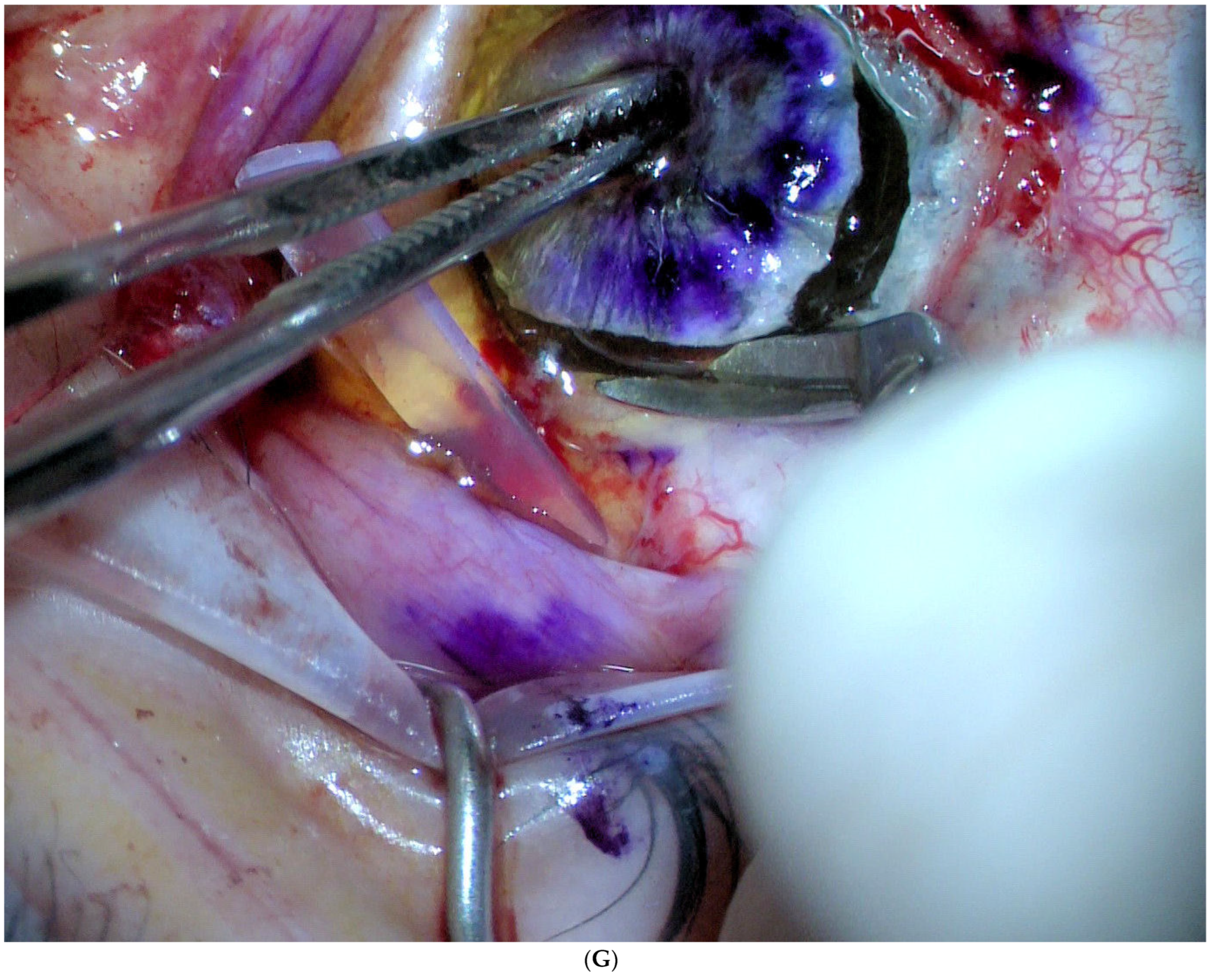 Jcm 11 07156 g001g Jcm 11 07156 g001g