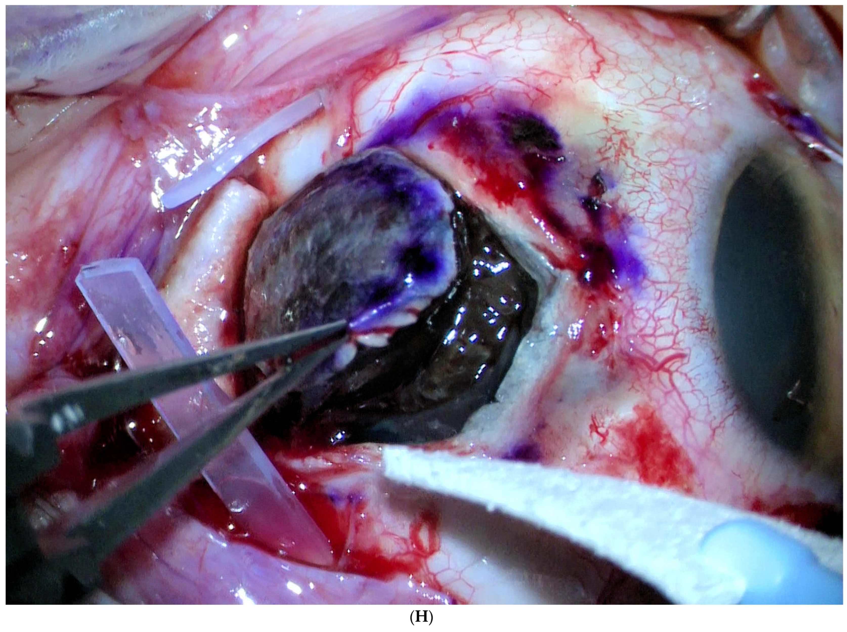 Jcm 11 07156 g001h Jcm 11 07156 g001h