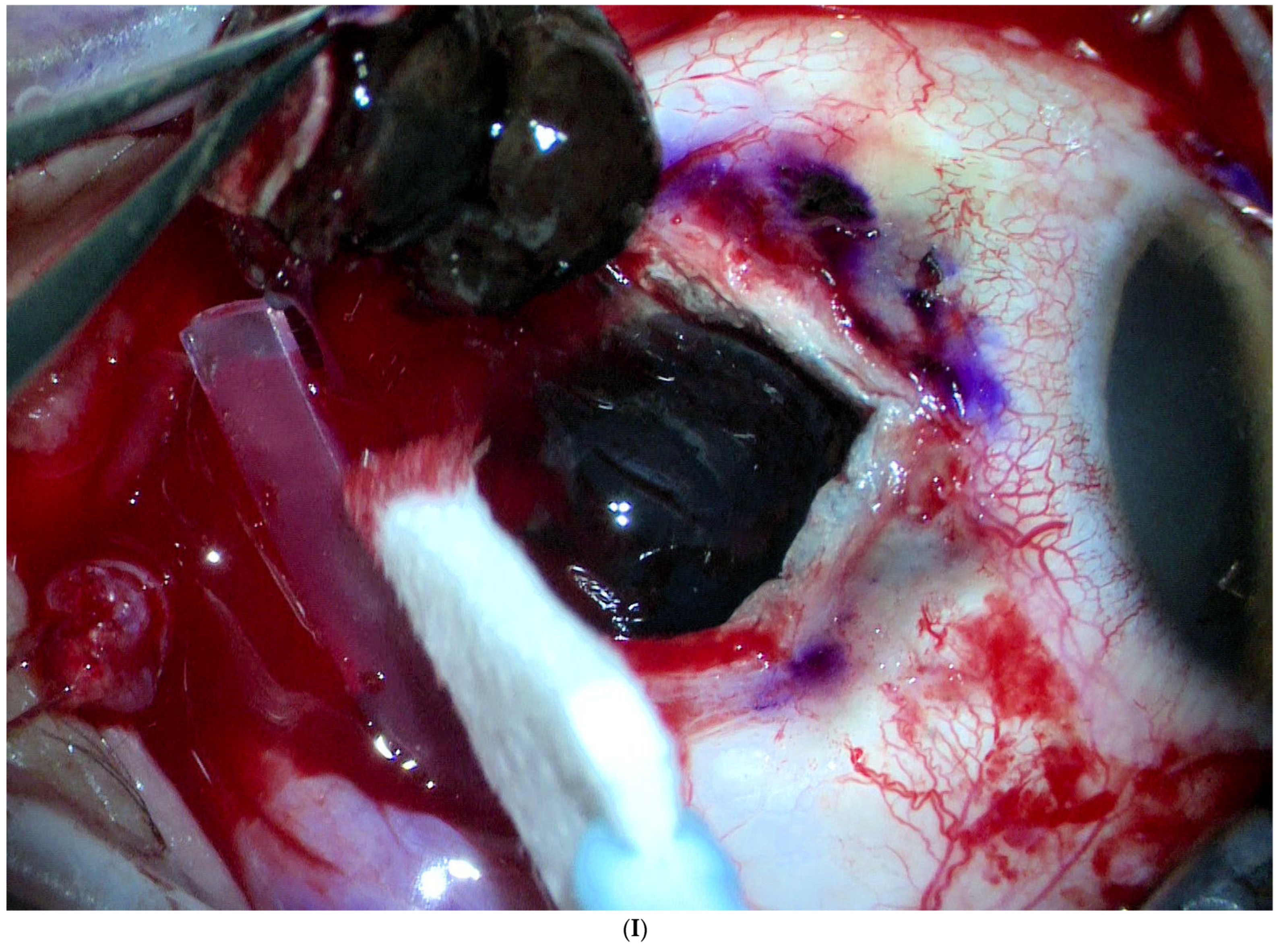 Jcm 11 07156 g001i Jcm 11 07156 g001i