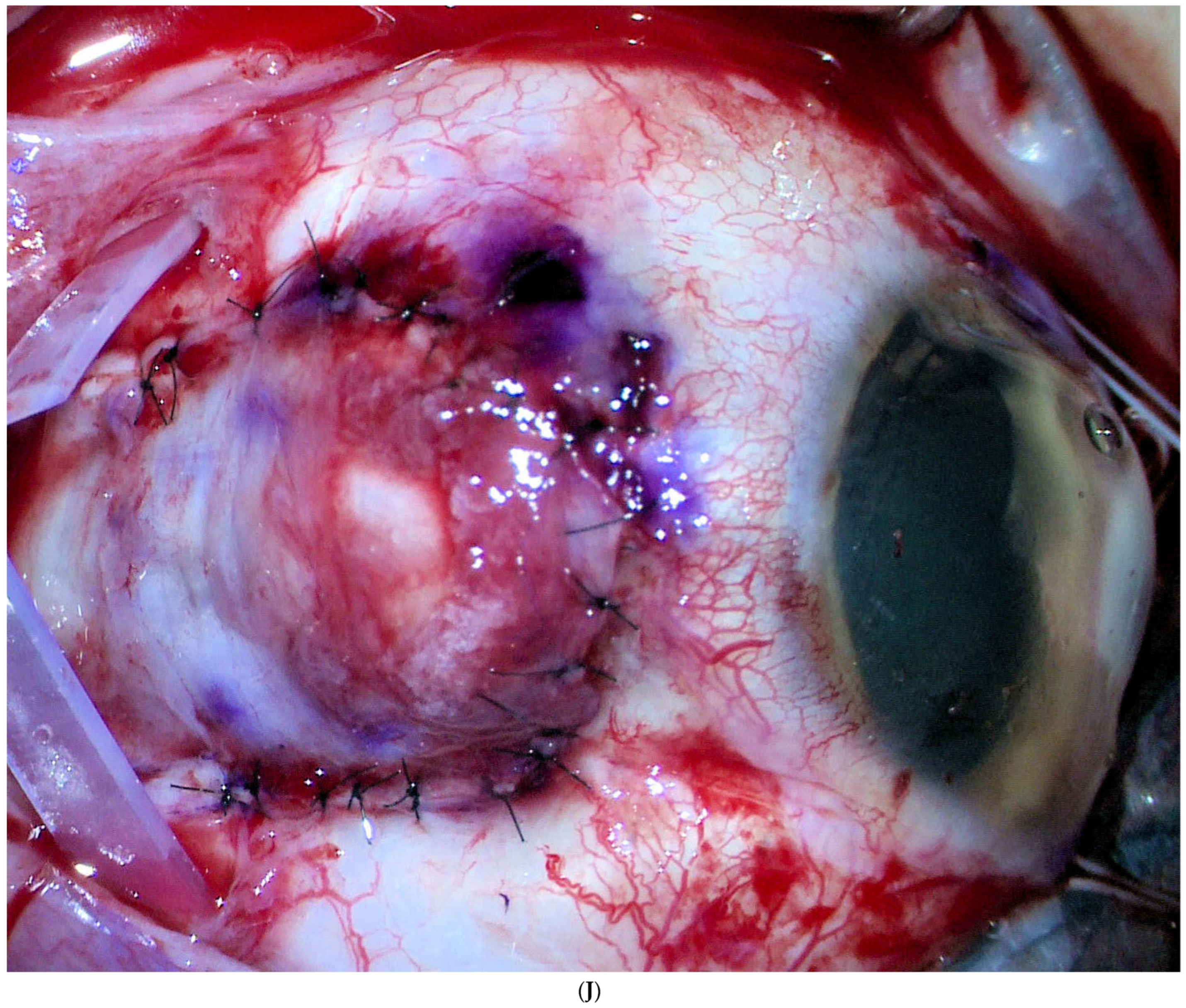 Jcm 11 07156 g001j Jcm 11 07156 g001j