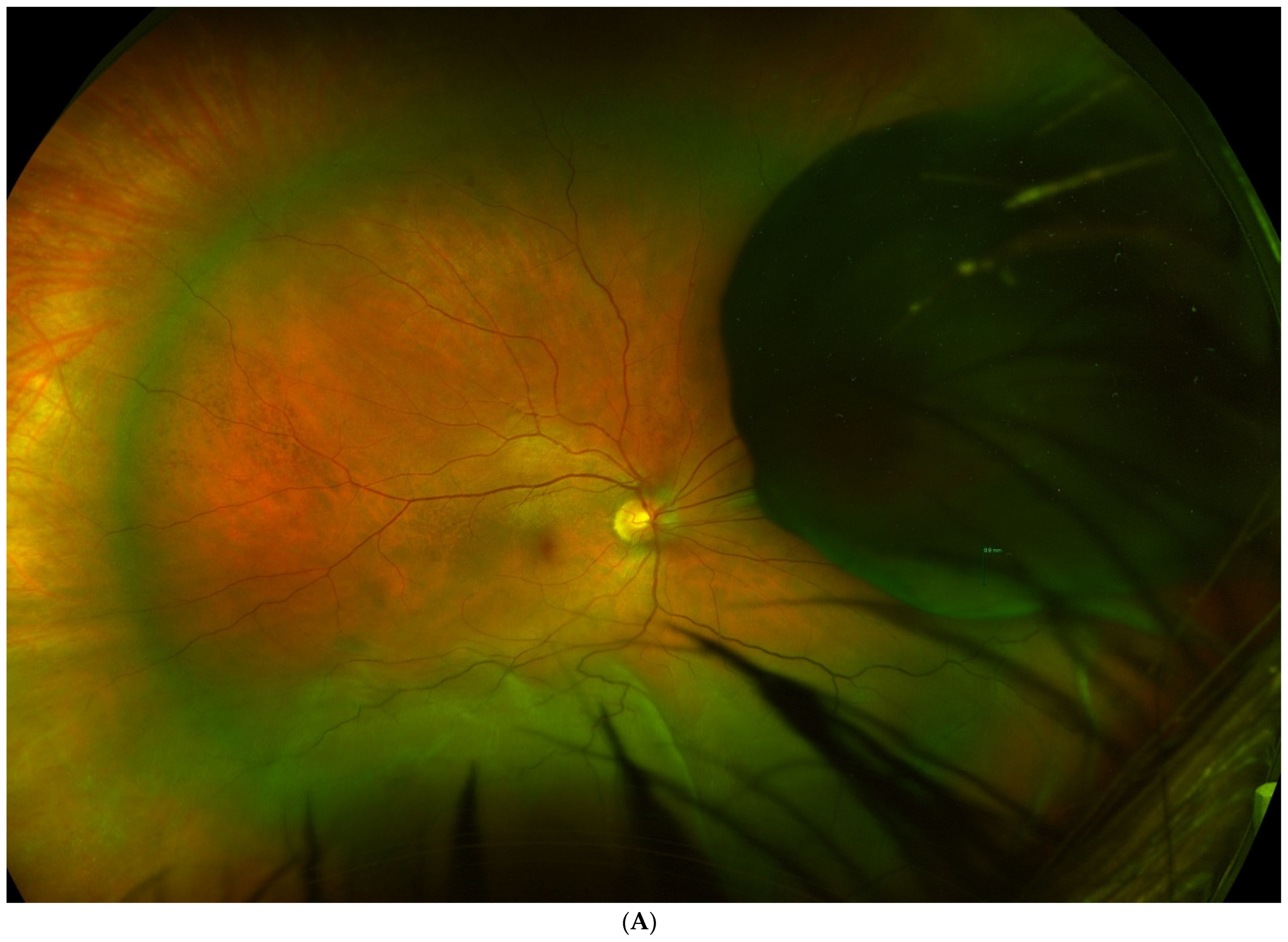 Jcm 11 07156 g002a Jcm 11 07156 g002a