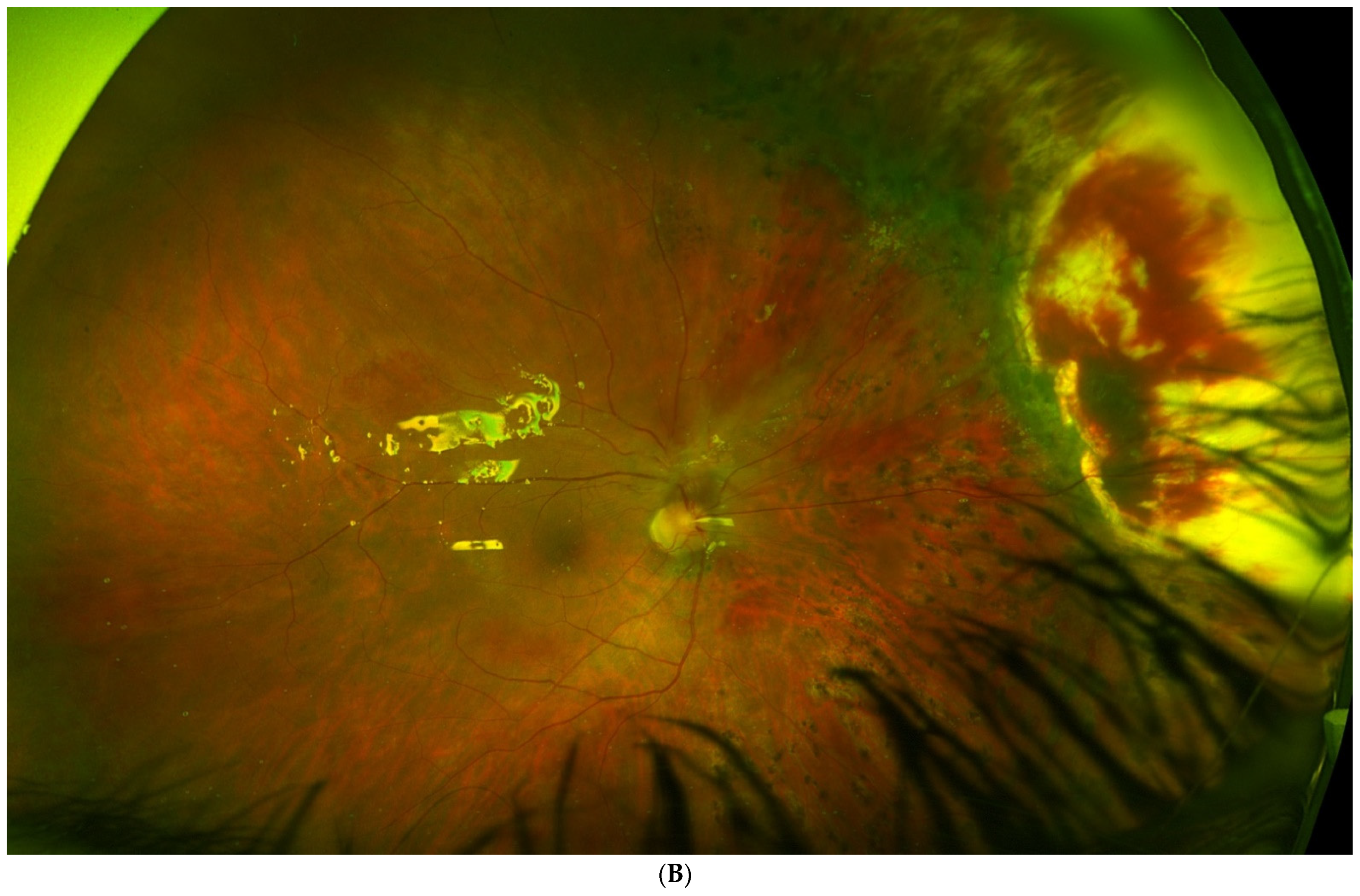 Jcm 11 07156 g002b Jcm 11 07156 g002b