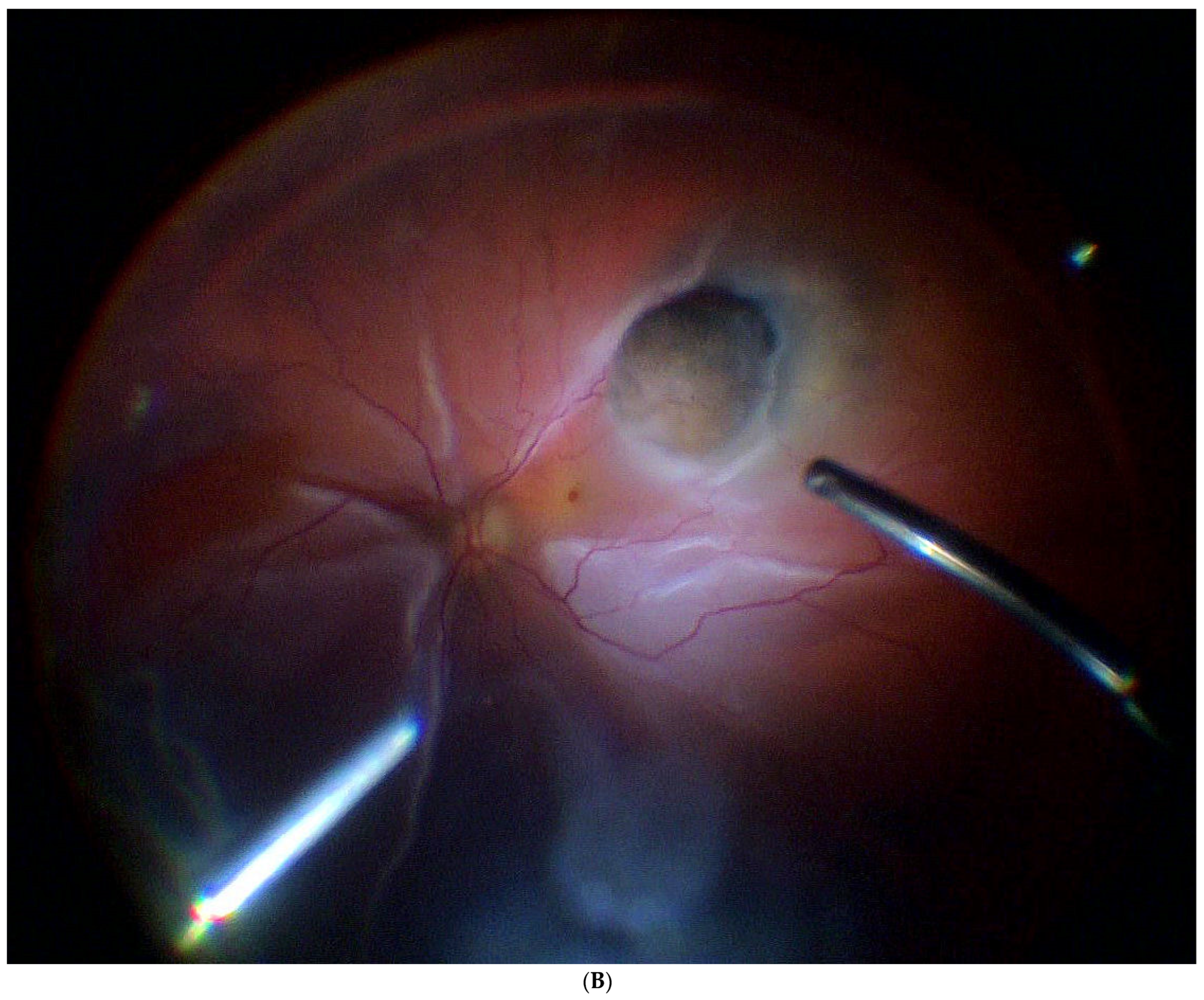 Jcm 11 07156 g003b Jcm 11 07156 g003b