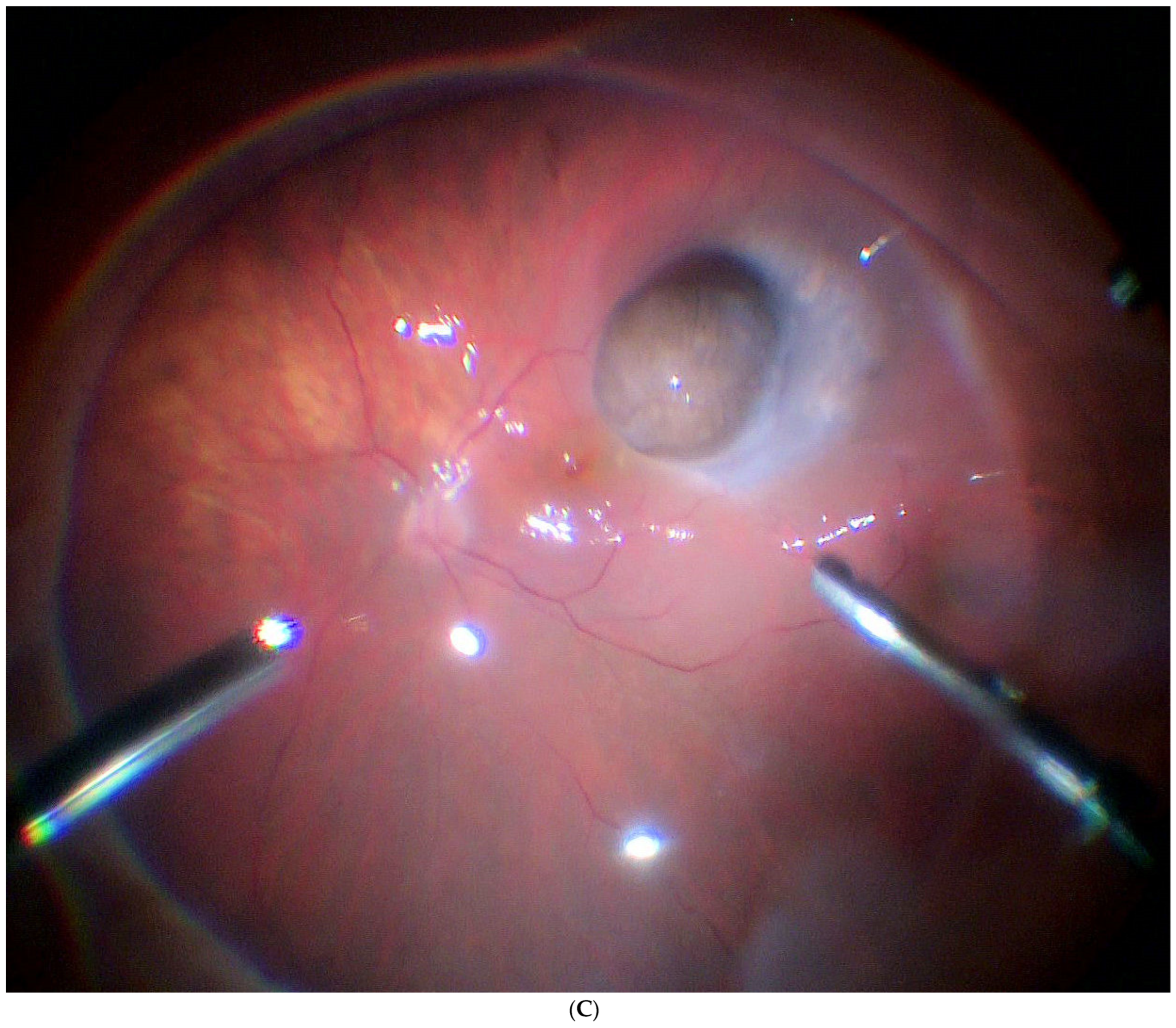 Jcm 11 07156 g003c Jcm 11 07156 g003c