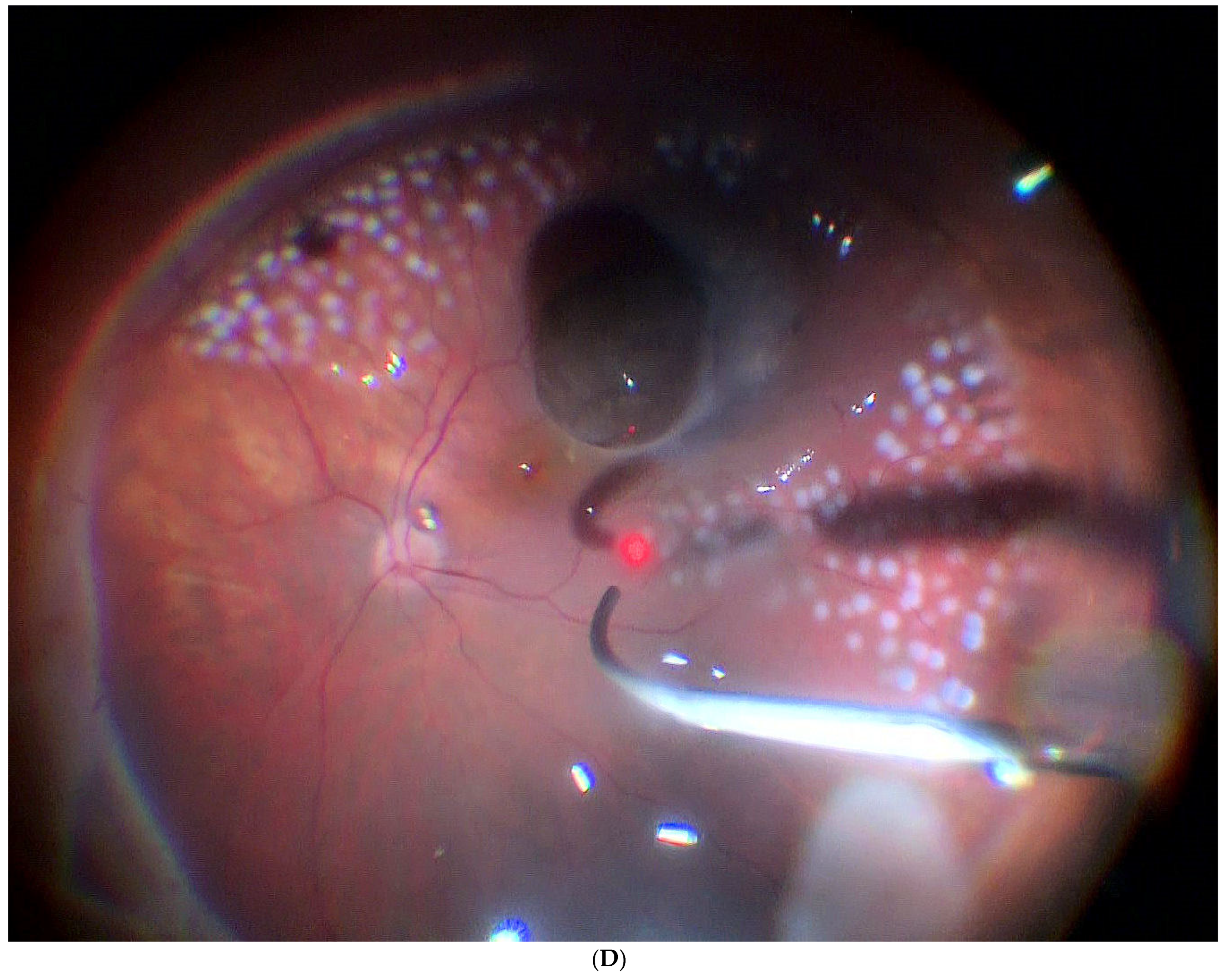 Jcm 11 07156 g003d Jcm 11 07156 g003d