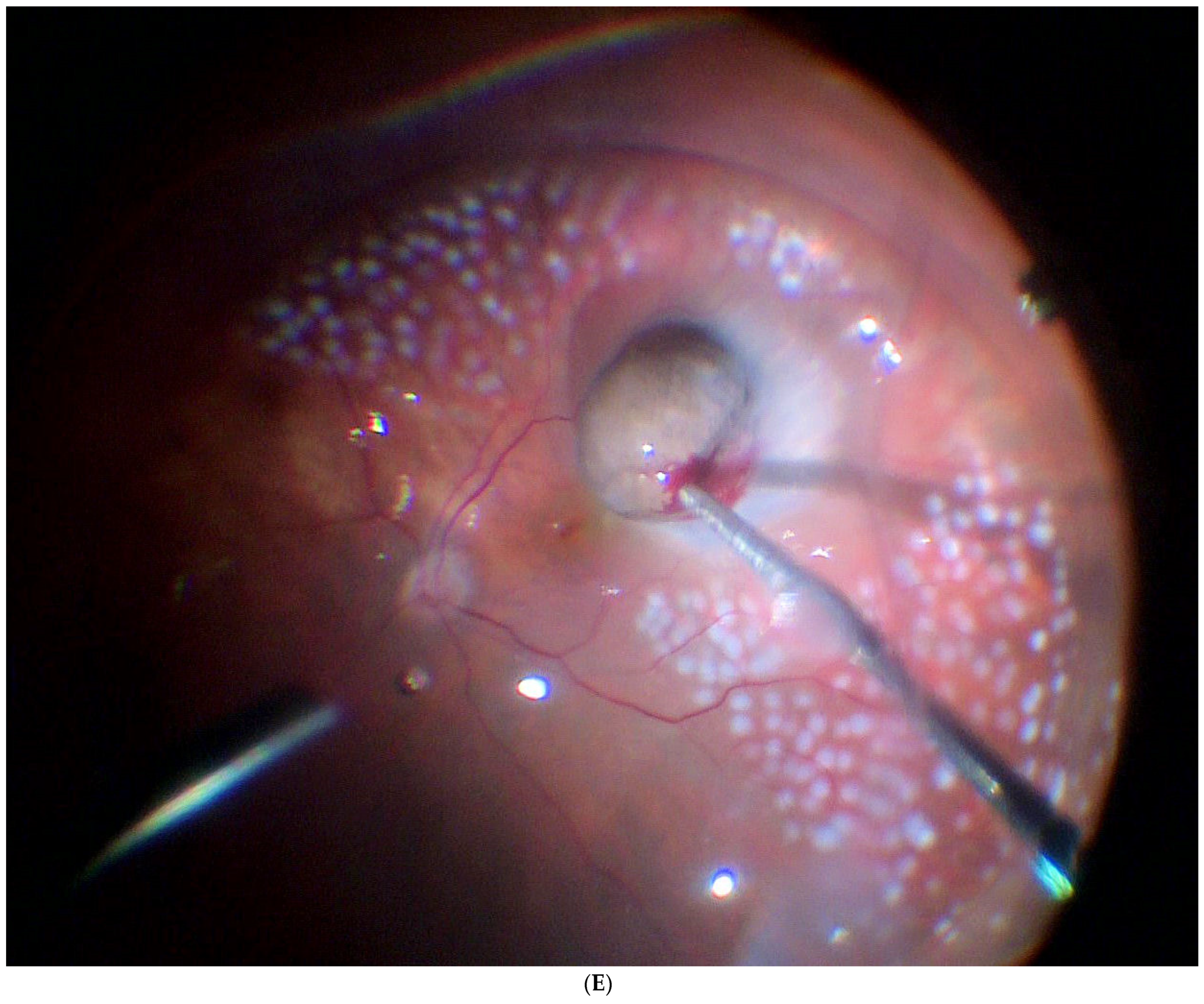 Jcm 11 07156 g003e Jcm 11 07156 g003e