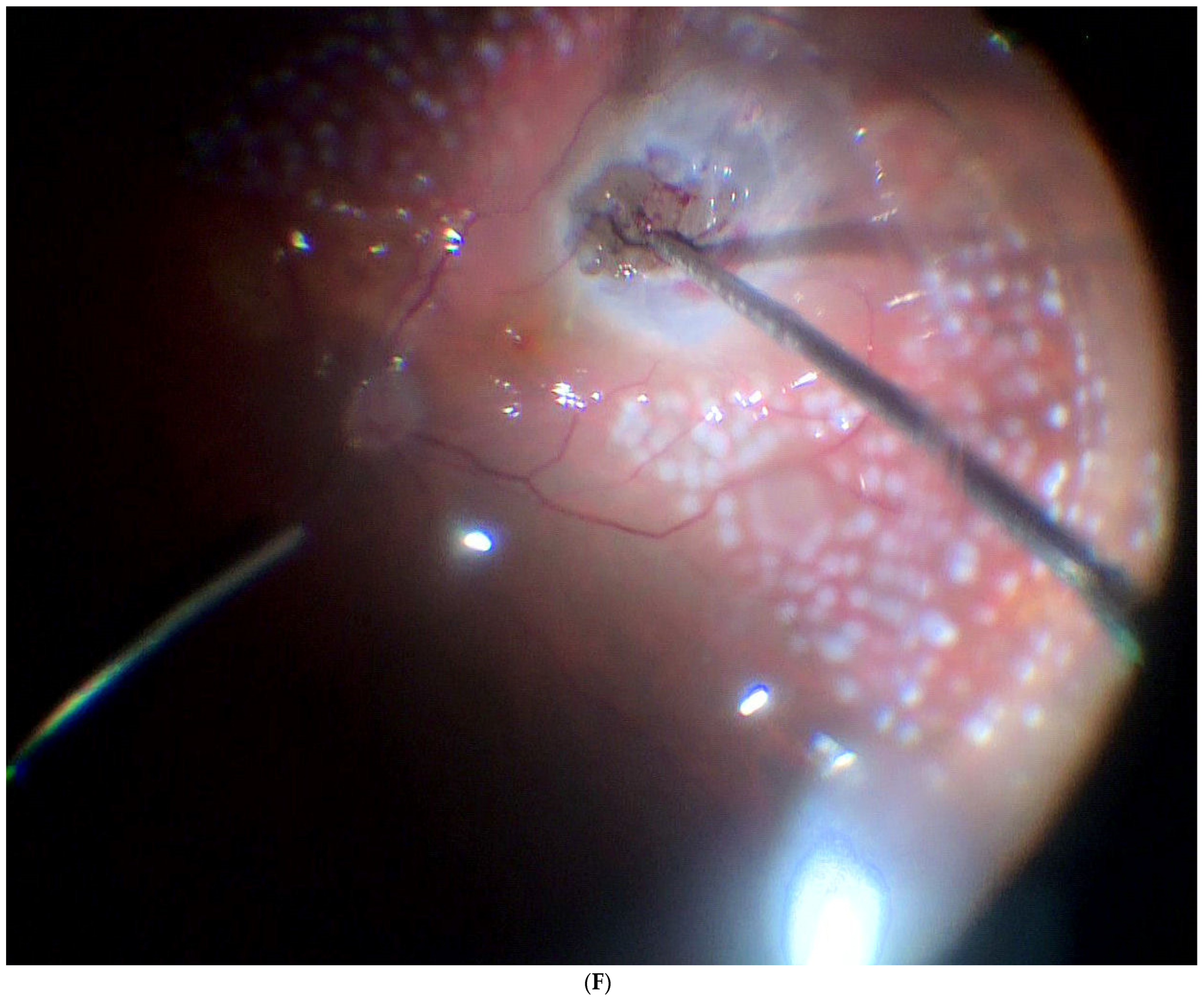 Jcm 11 07156 g003f Jcm 11 07156 g003f