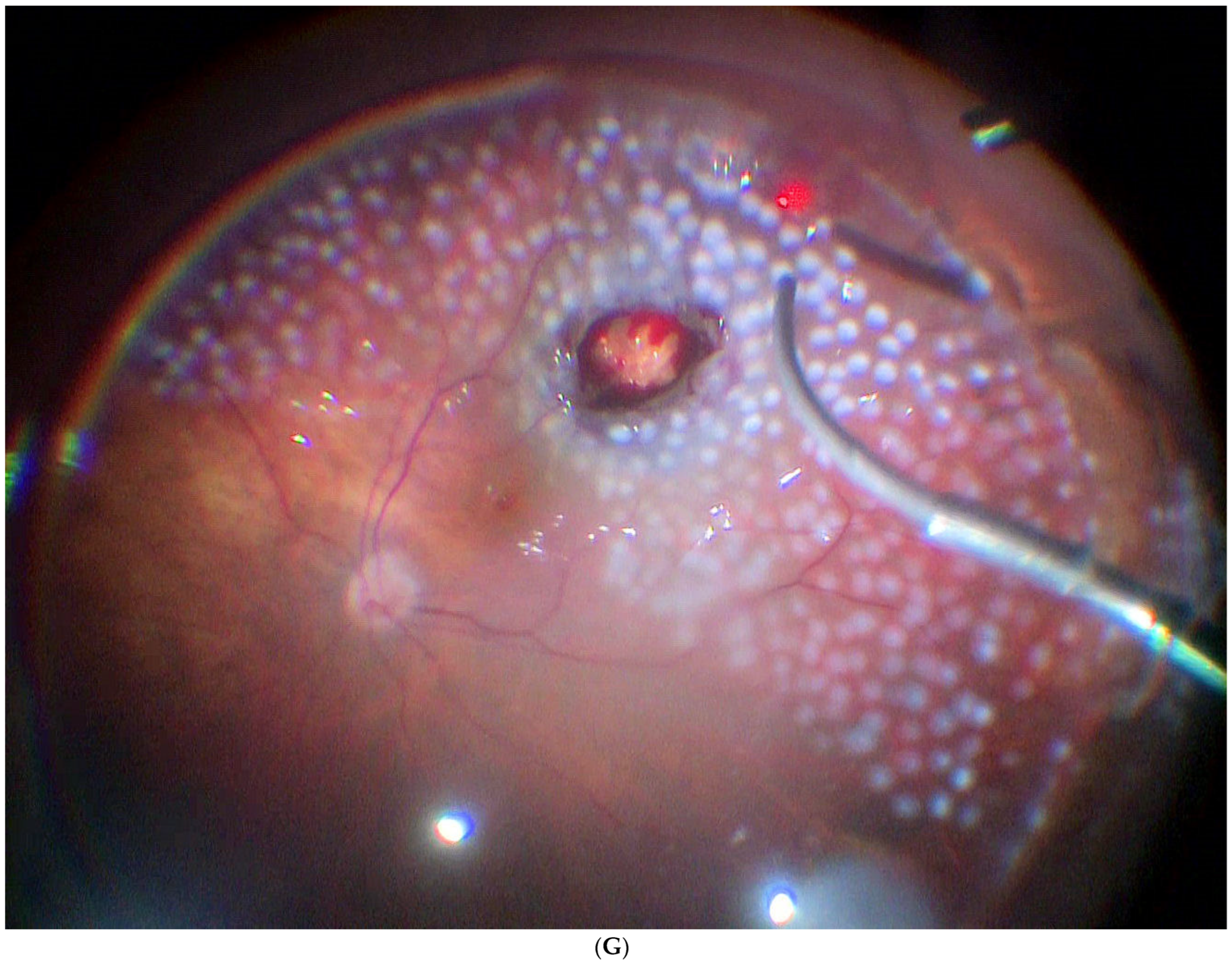 Jcm 11 07156 g003g Jcm 11 07156 g003g