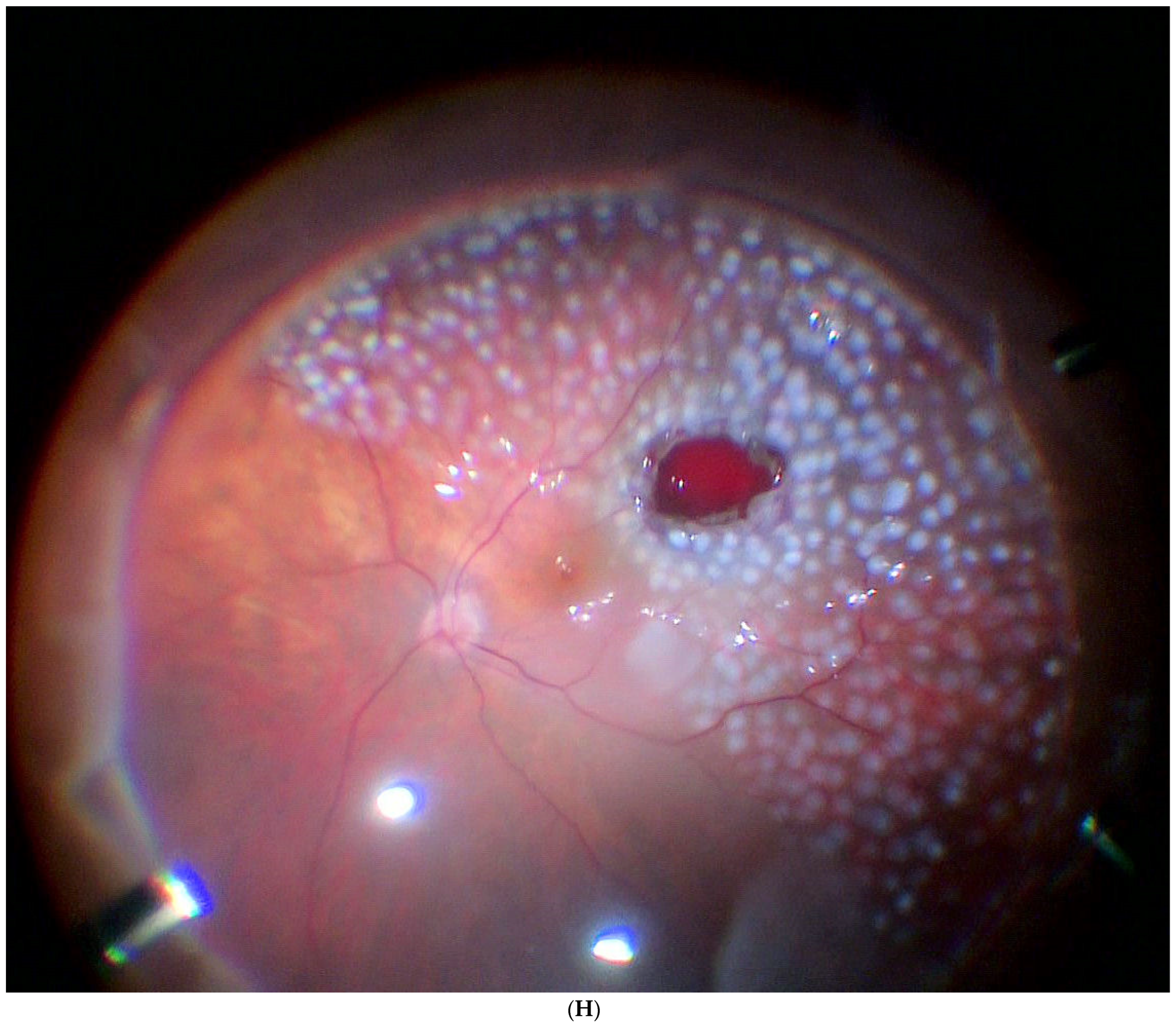 Jcm 11 07156 g003h Jcm 11 07156 g003h