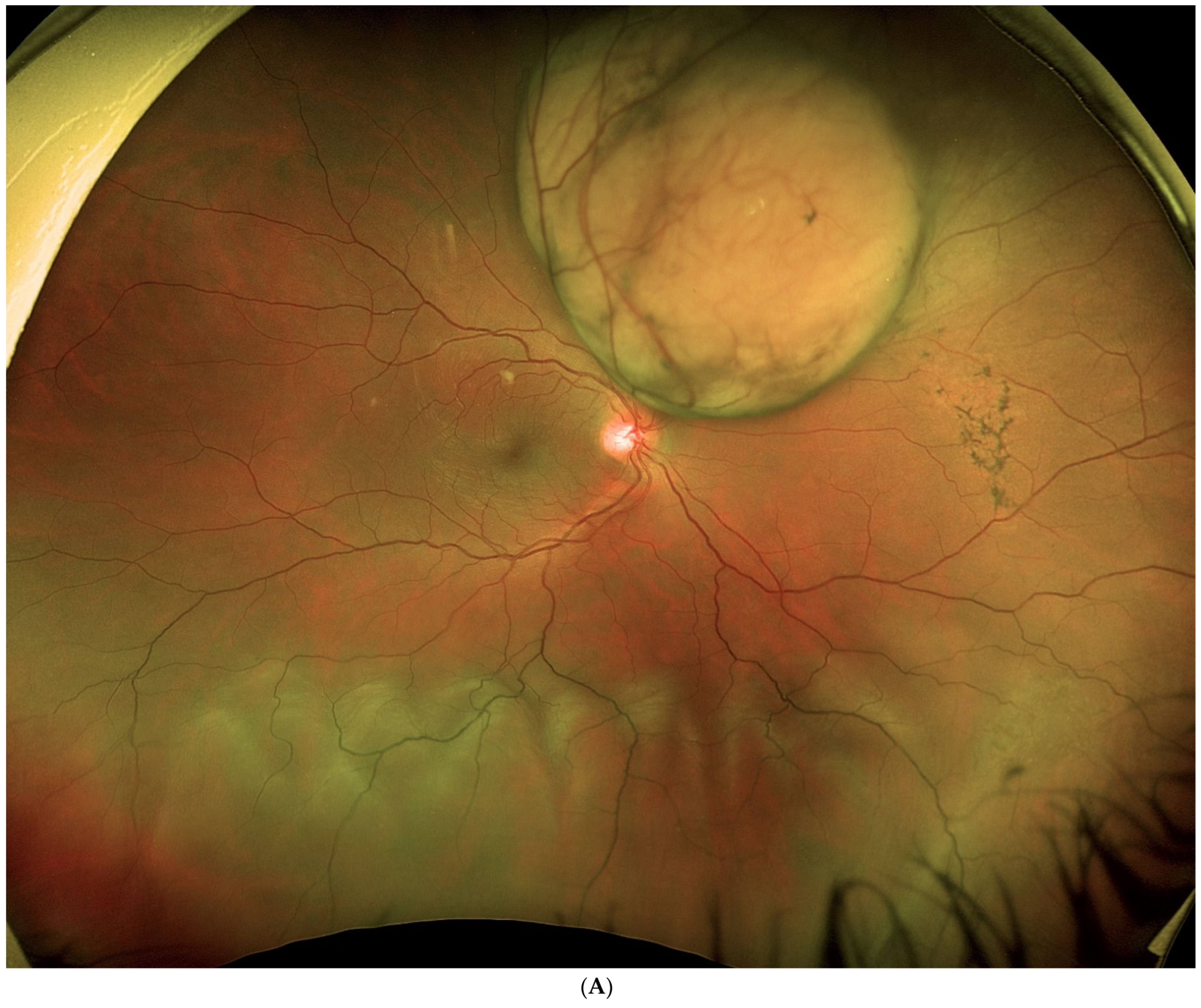 Jcm 11 07156 g004a Jcm 11 07156 g004a