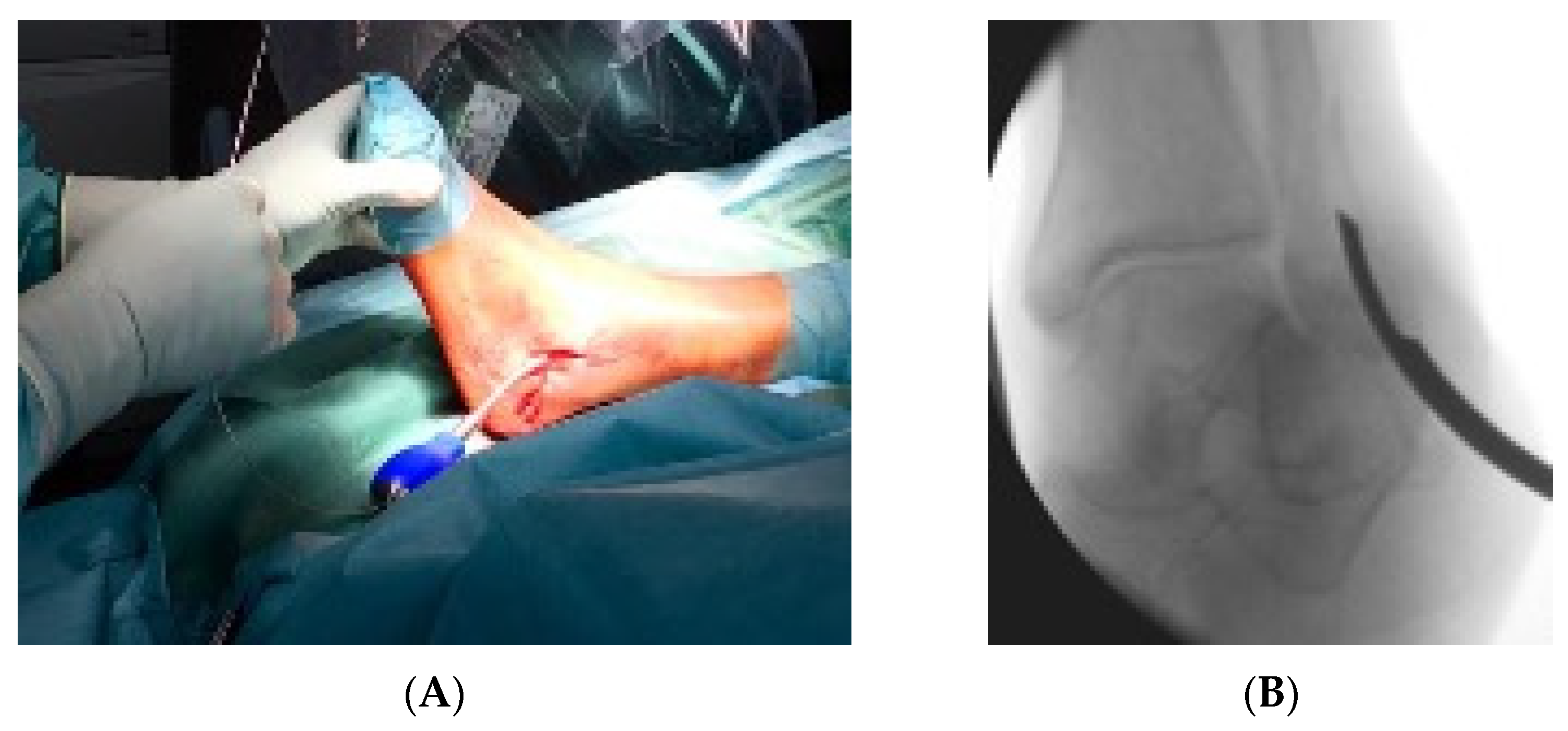 Jcm 11 07178 g002 Jcm 11 07178 g002