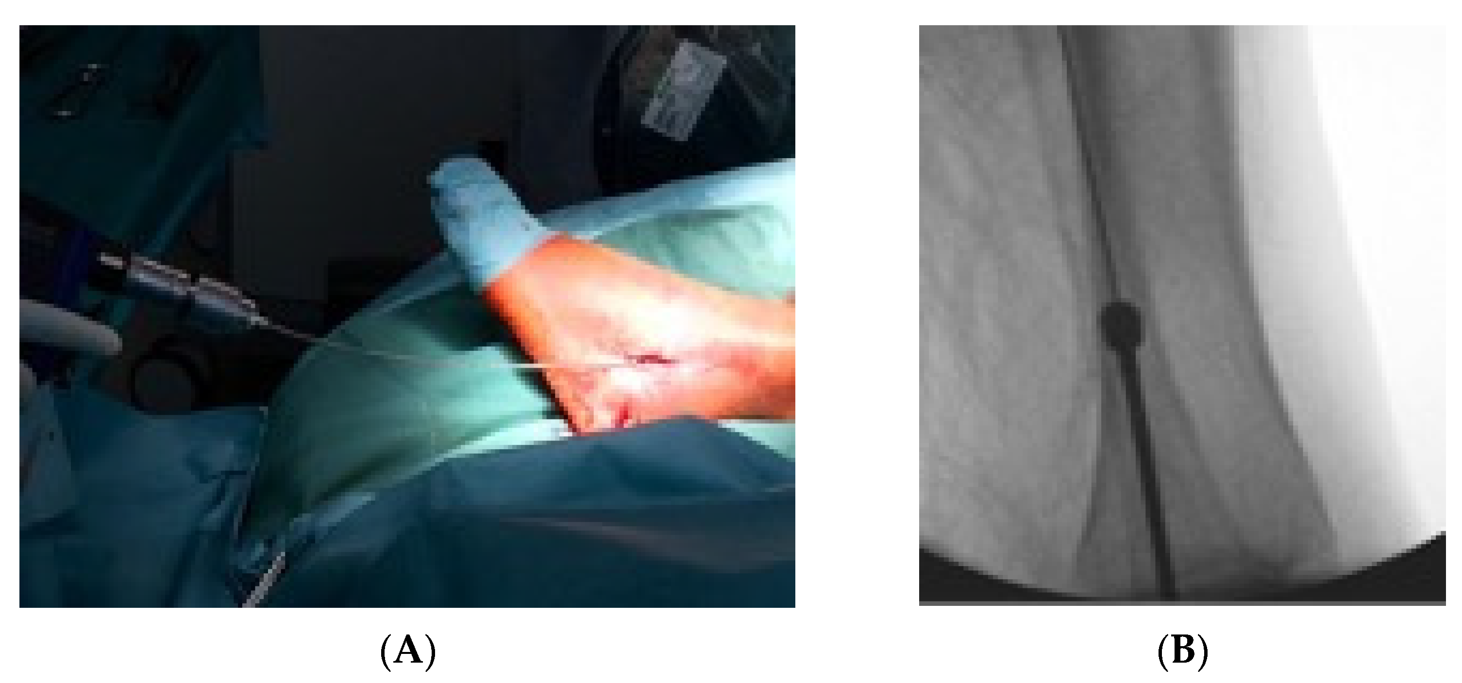 Jcm 11 07178 g003 Jcm 11 07178 g003