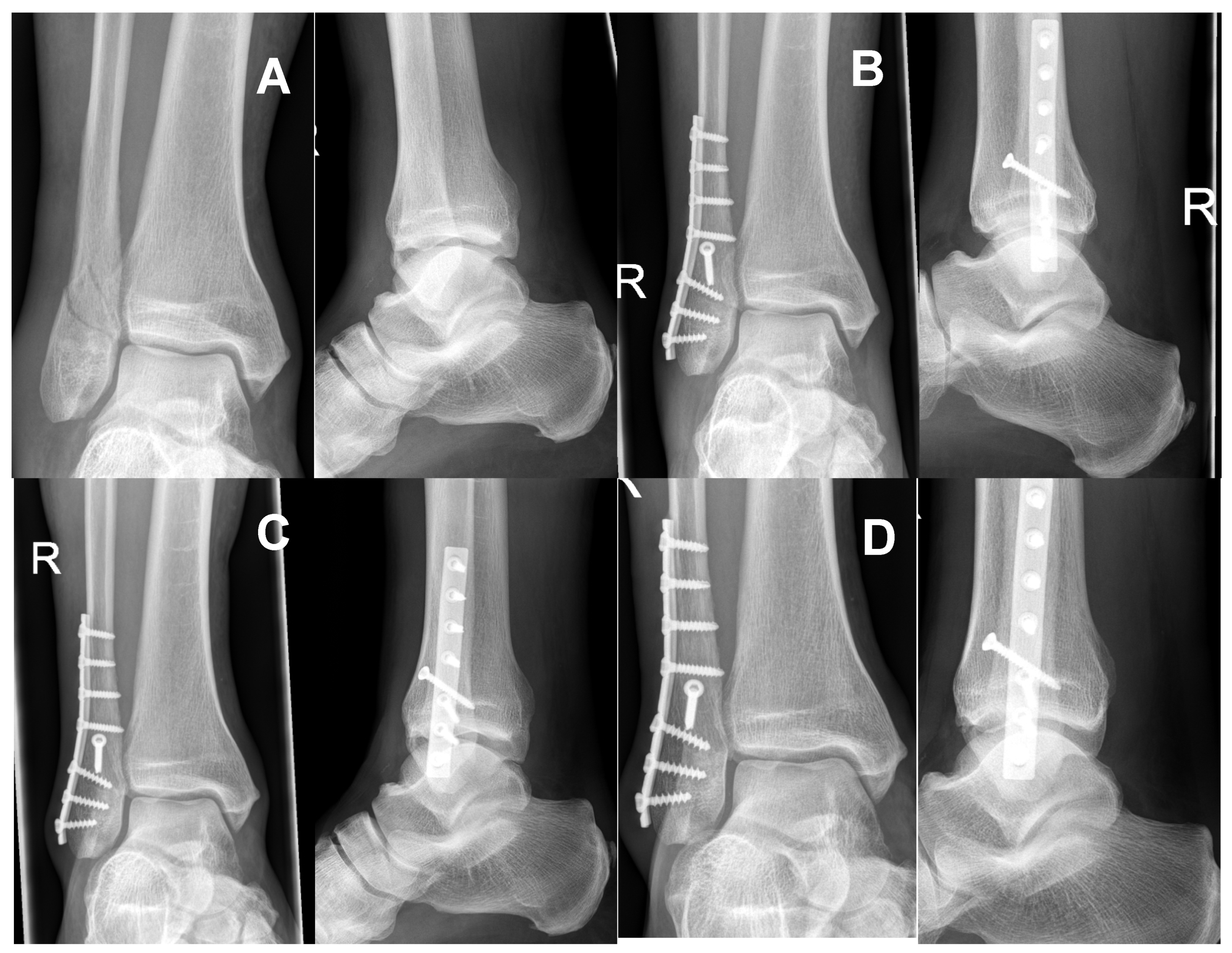 Jcm 11 07178 g008 Jcm 11 07178 g008