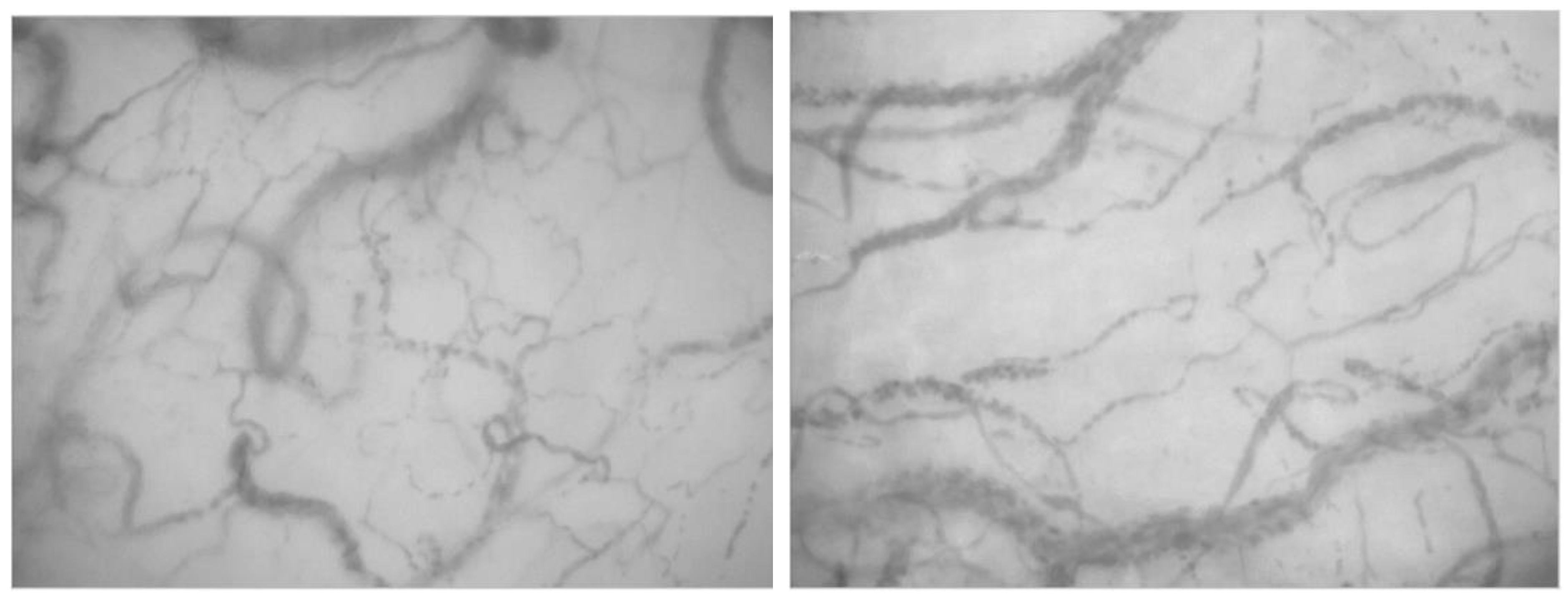 Jcm 11 07277 g002 Jcm 11 07277 g002