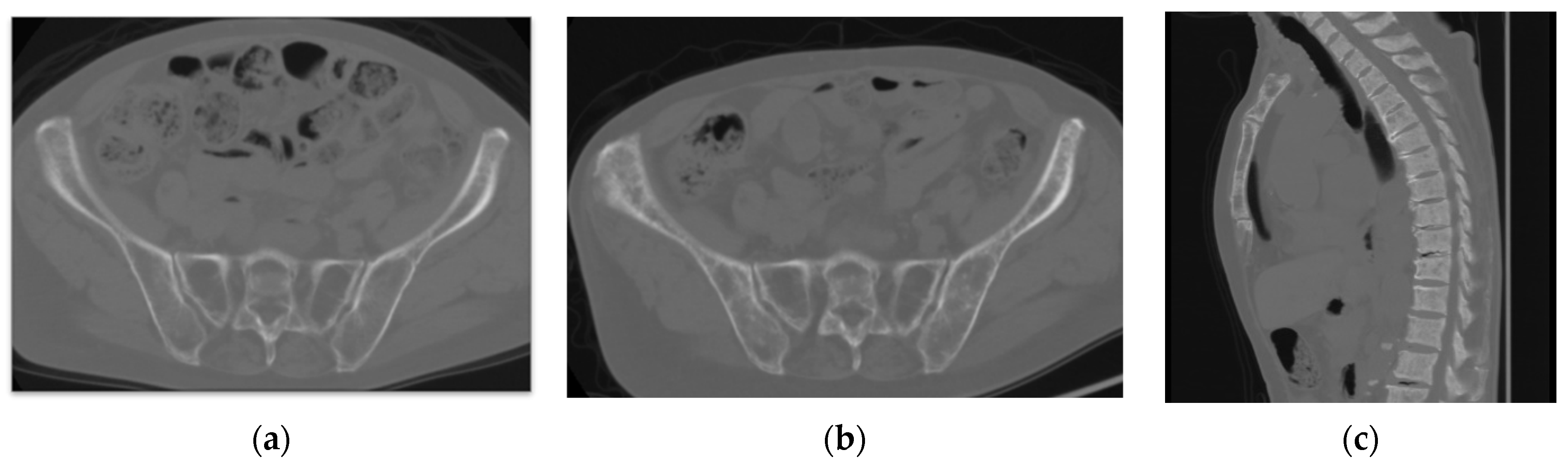 Jcm 11 07306 g002 Jcm 11 07306 g002