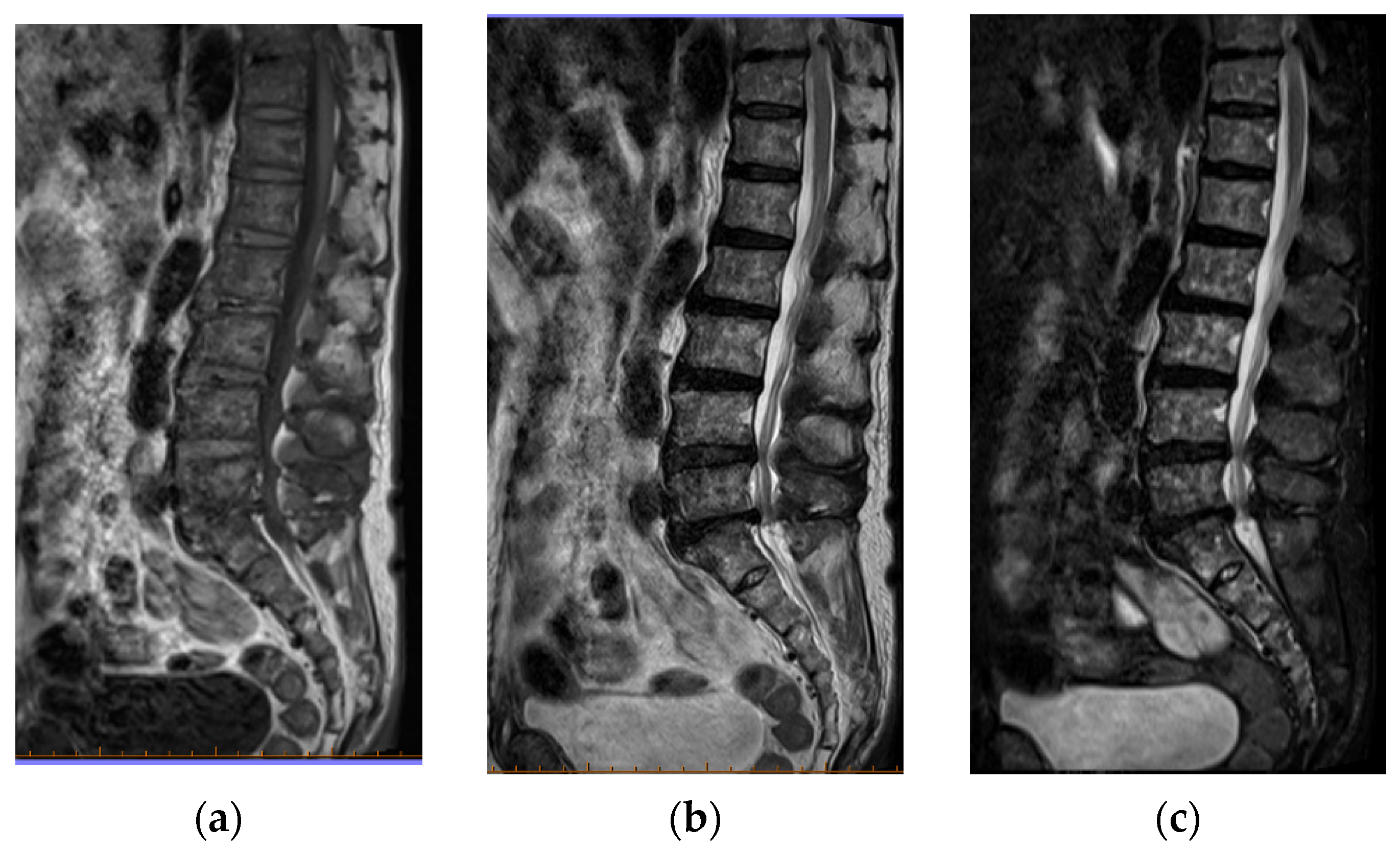 Jcm 11 07306 g003 Jcm 11 07306 g003