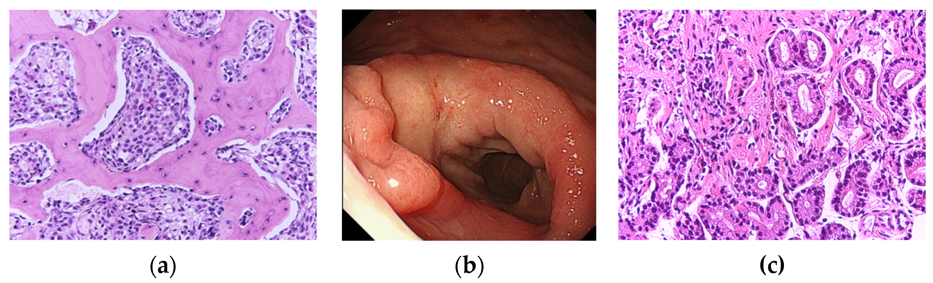 Jcm 11 07306 g004 Jcm 11 07306 g004