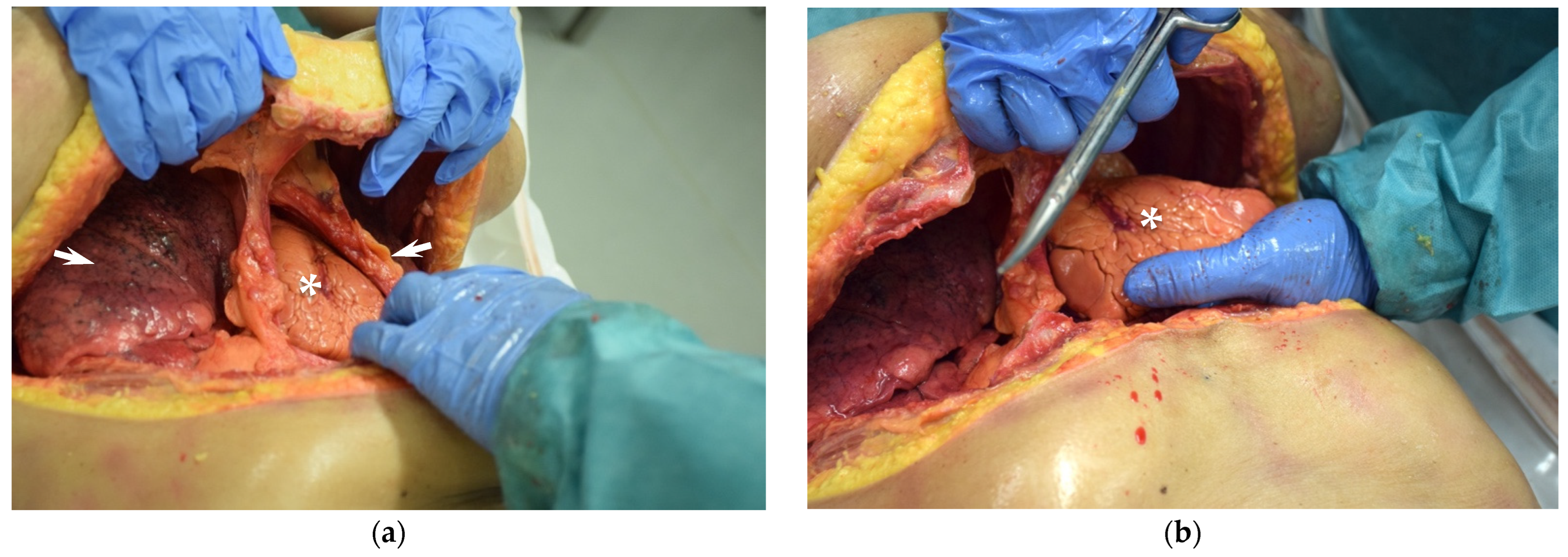 Jcm 11 07315 g005 Jcm 11 07315 g005