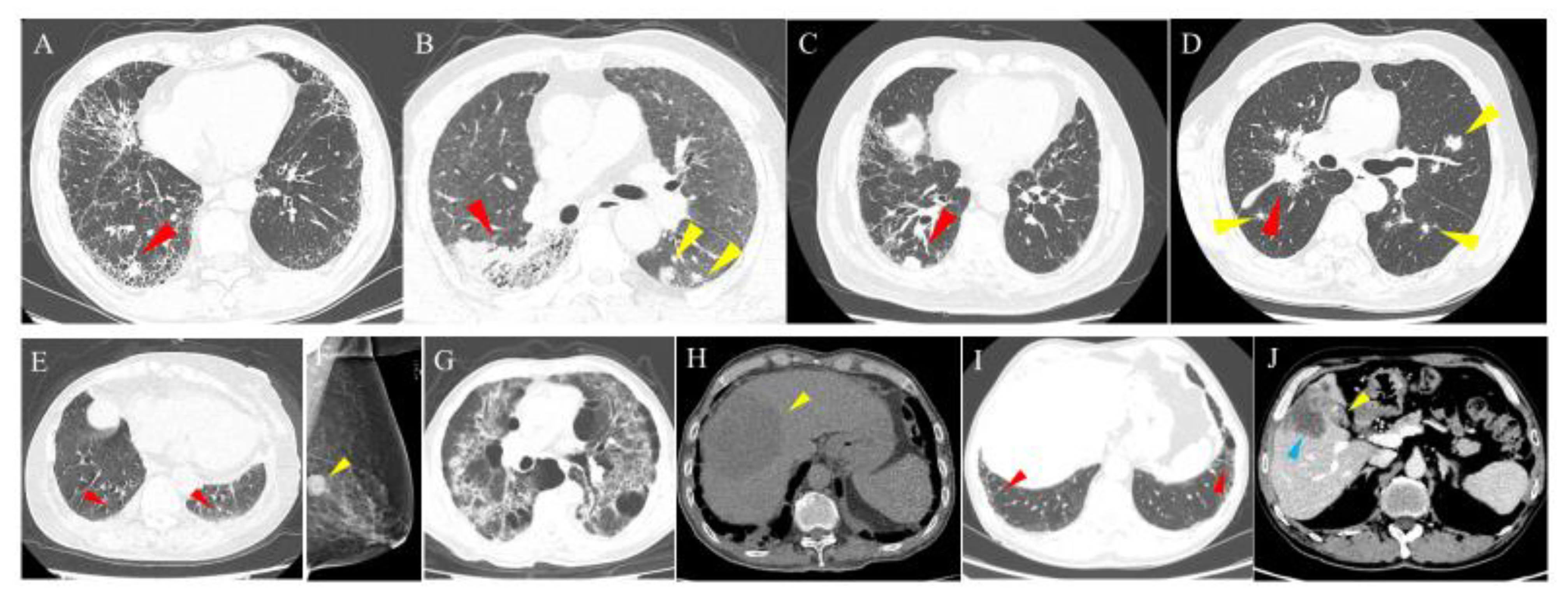 Jcm 11 07321 g004 Jcm 11 07321 g004