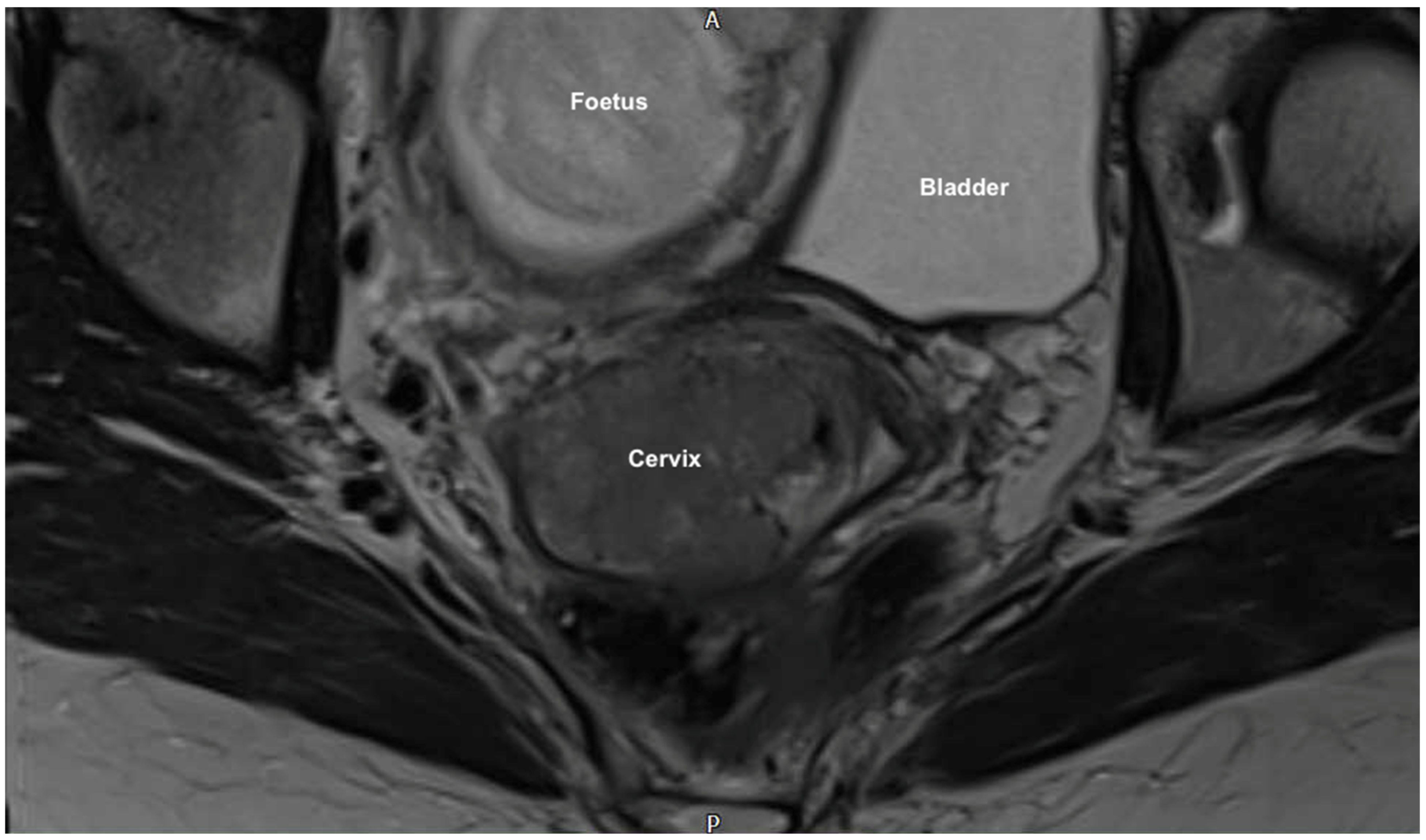 Jcm 11 07352 g002 Jcm 11 07352 g002