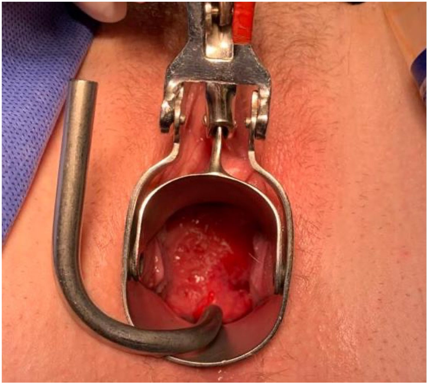 Jcm 11 07352 g003 Jcm 11 07352 g003