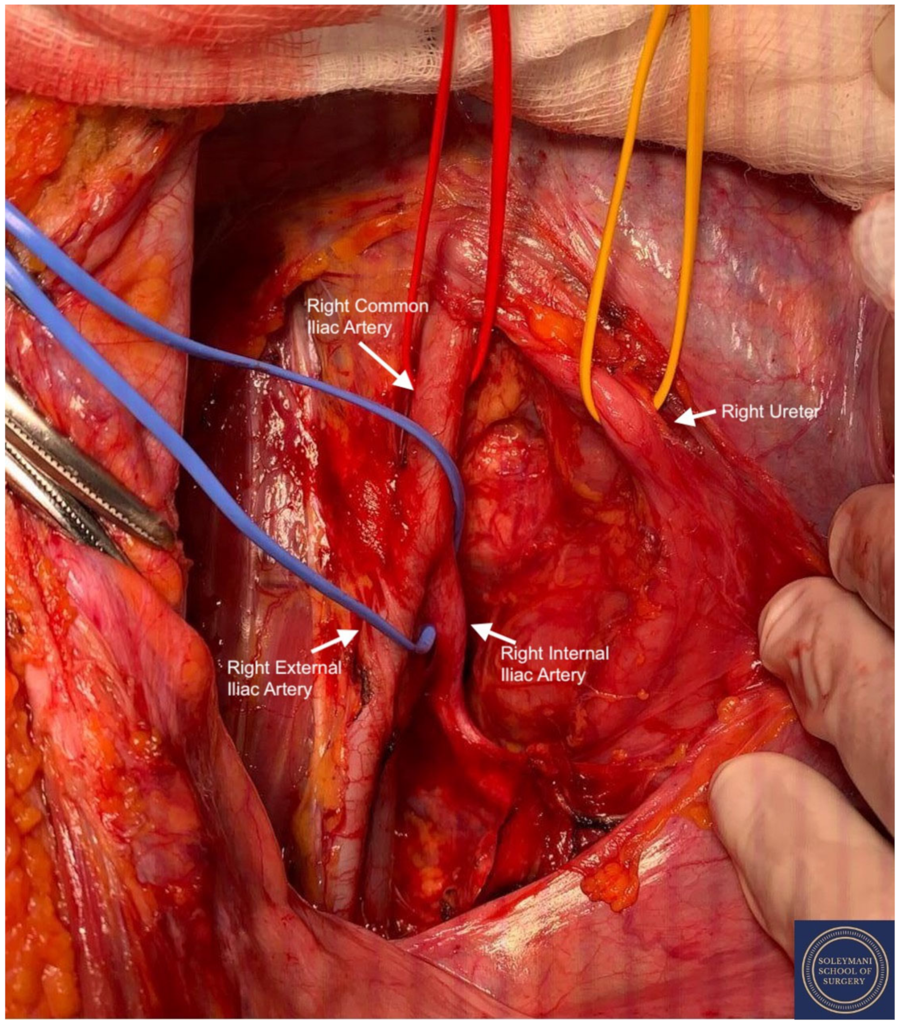 Jcm 11 07352 g006 Jcm 11 07352 g006