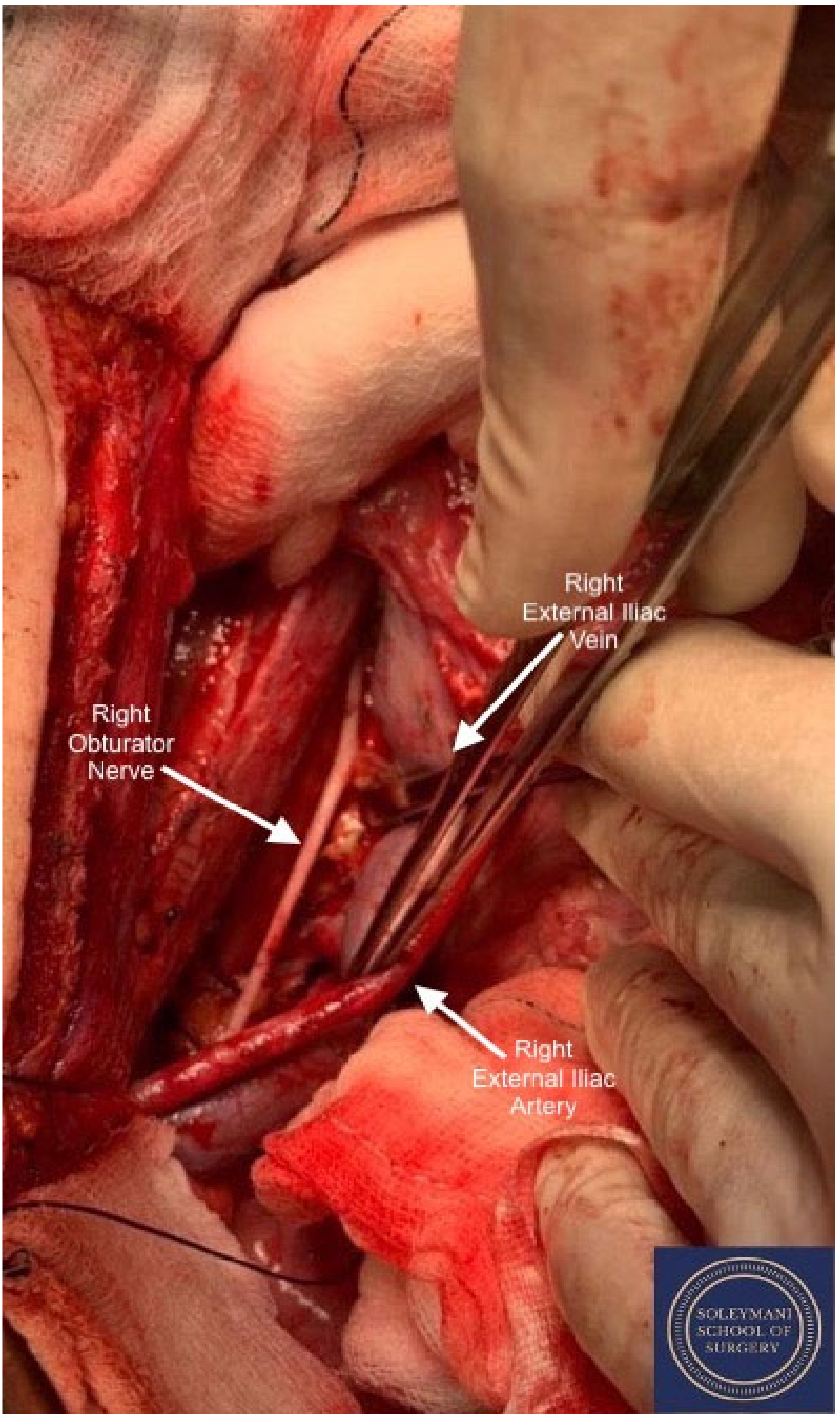 Jcm 11 07352 g008 Jcm 11 07352 g008
