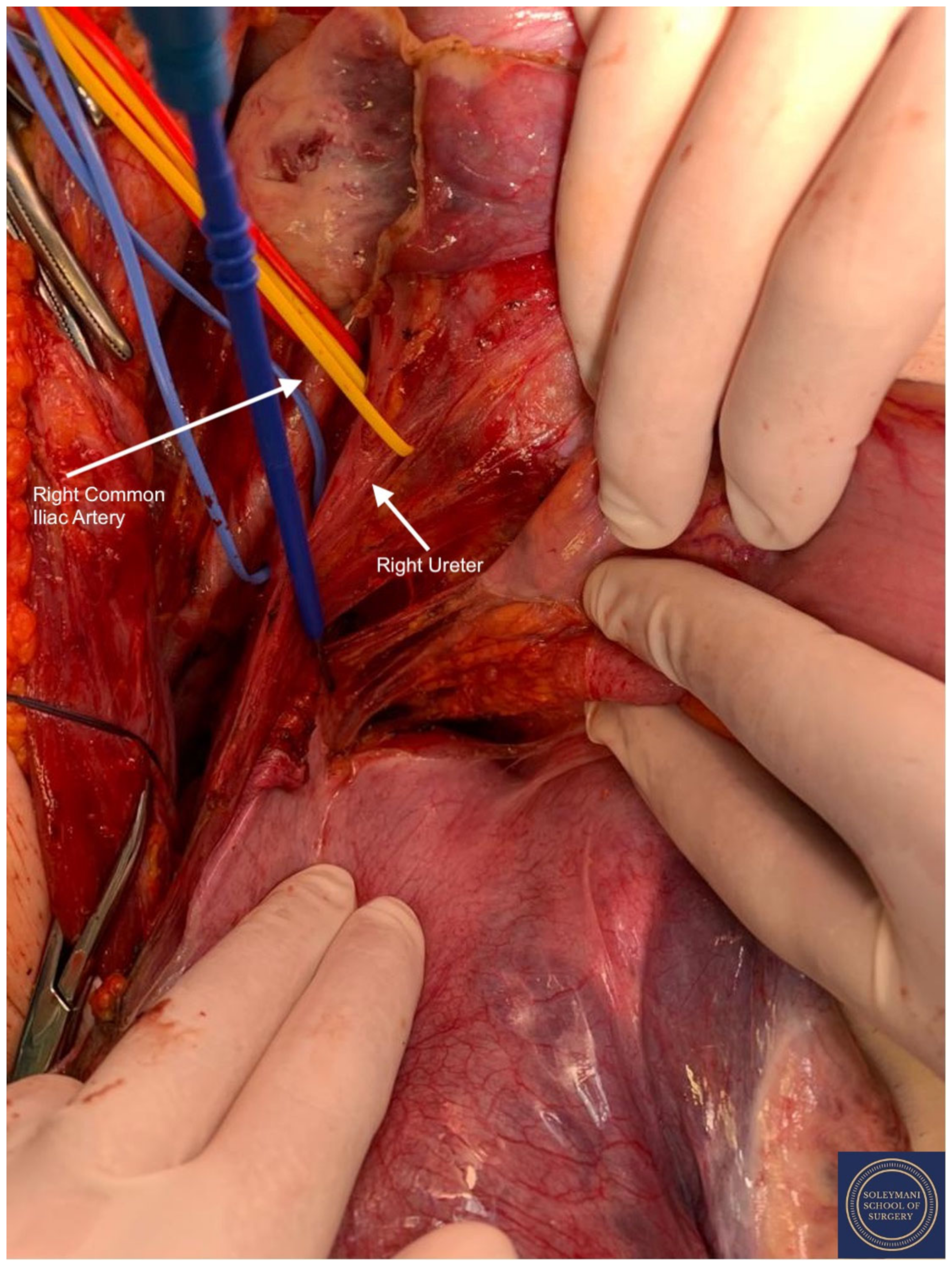 Jcm 11 07352 g011 Jcm 11 07352 g011