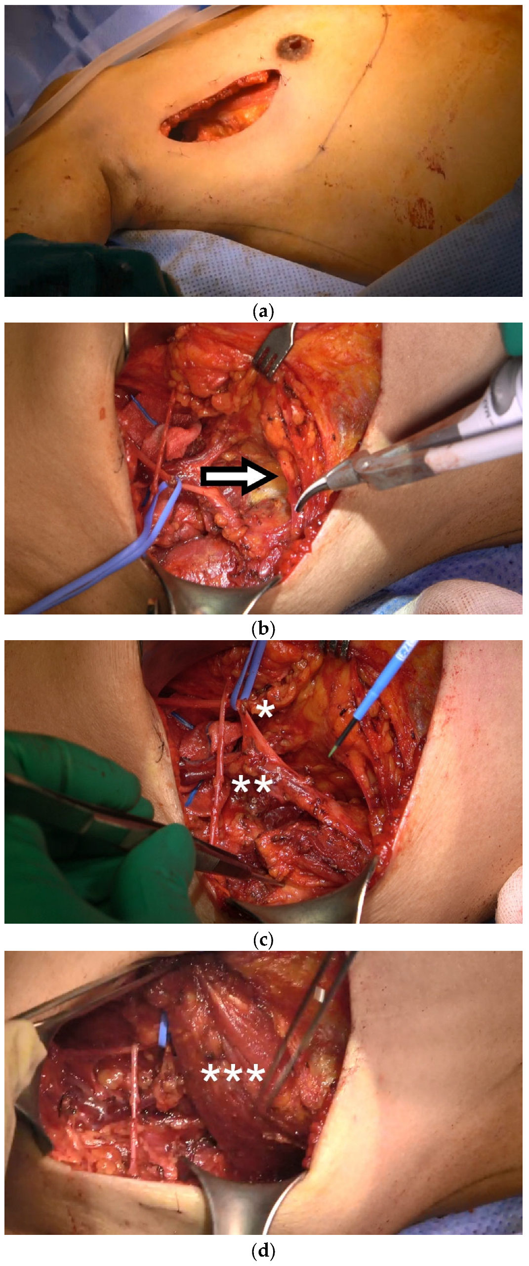 Jcm 11 07387 g002a Jcm 11 07387 g002a