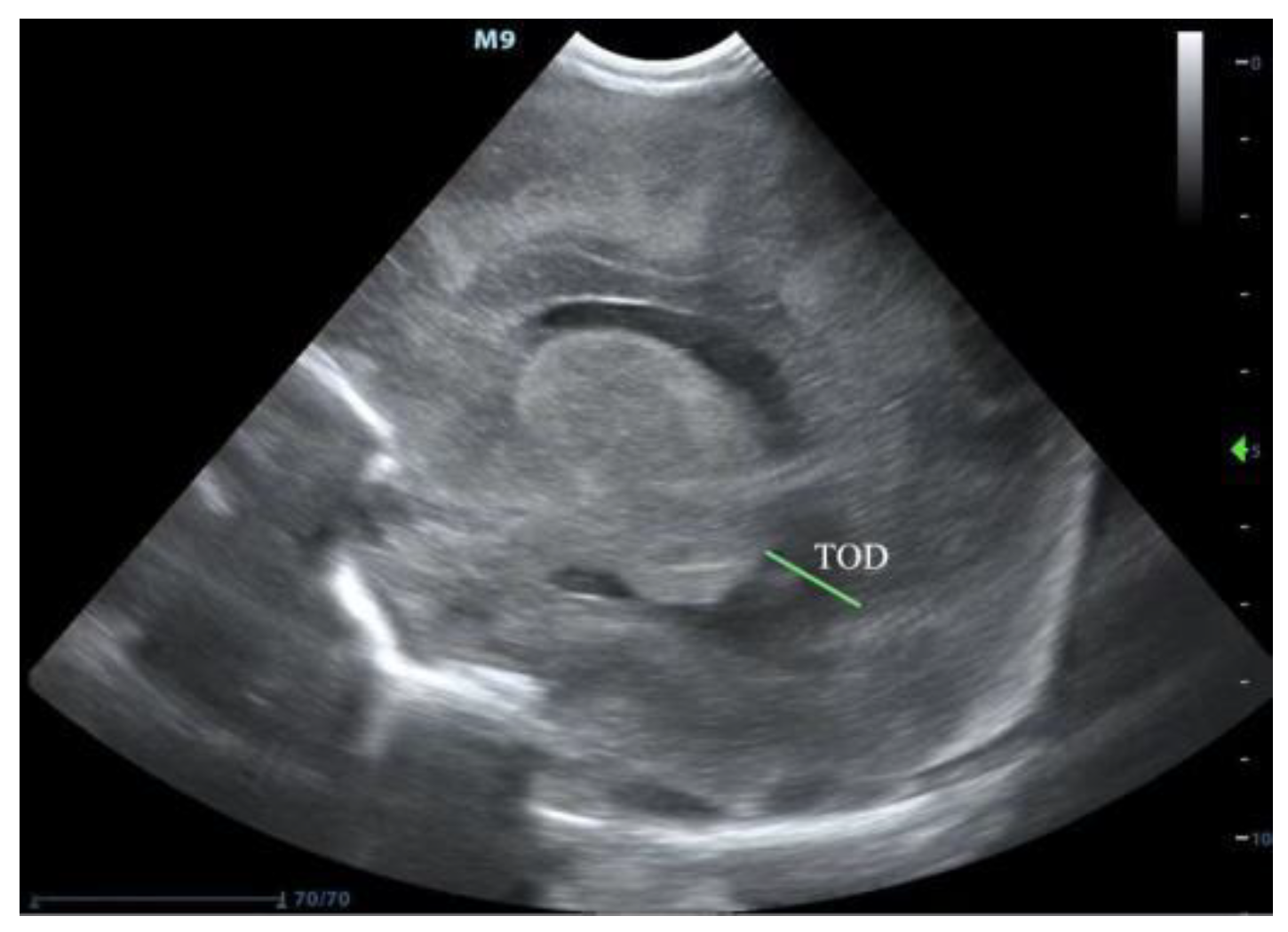 Jcm 11 07468 g002 Jcm 11 07468 g002