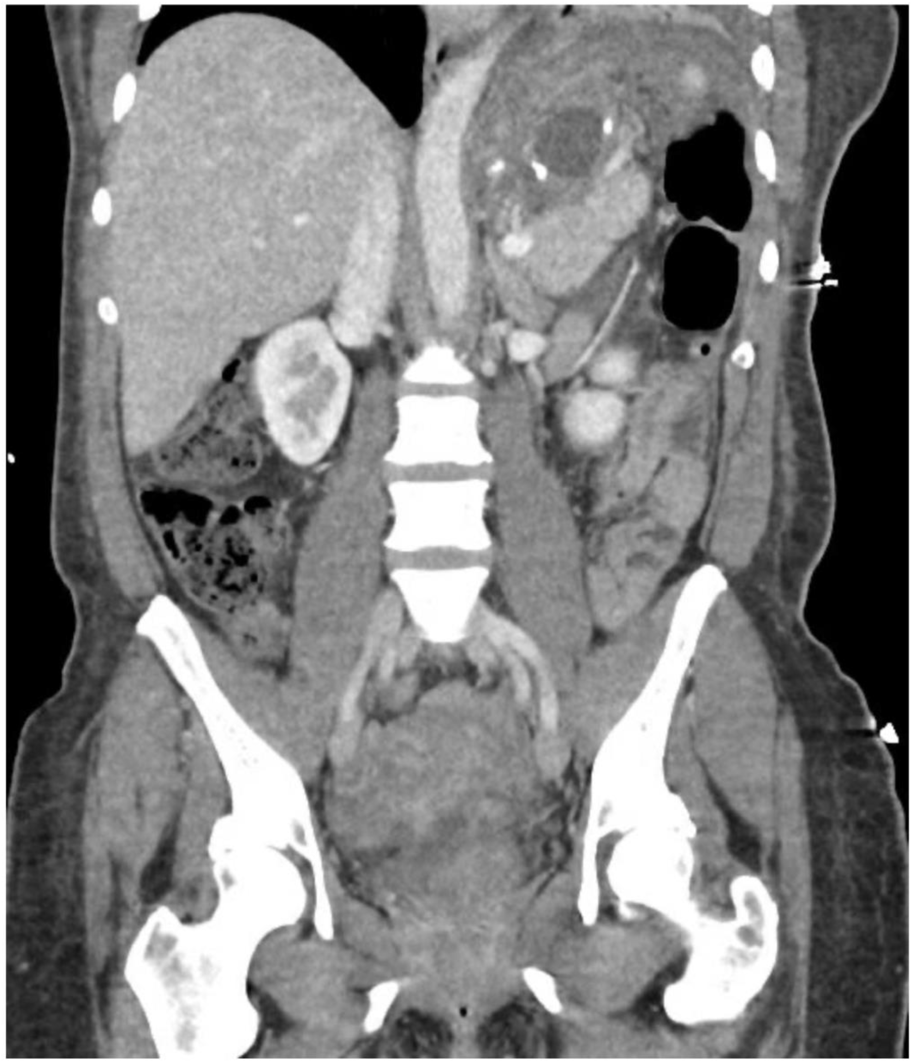 Jcm 11 07487 g001 Jcm 11 07487 g001