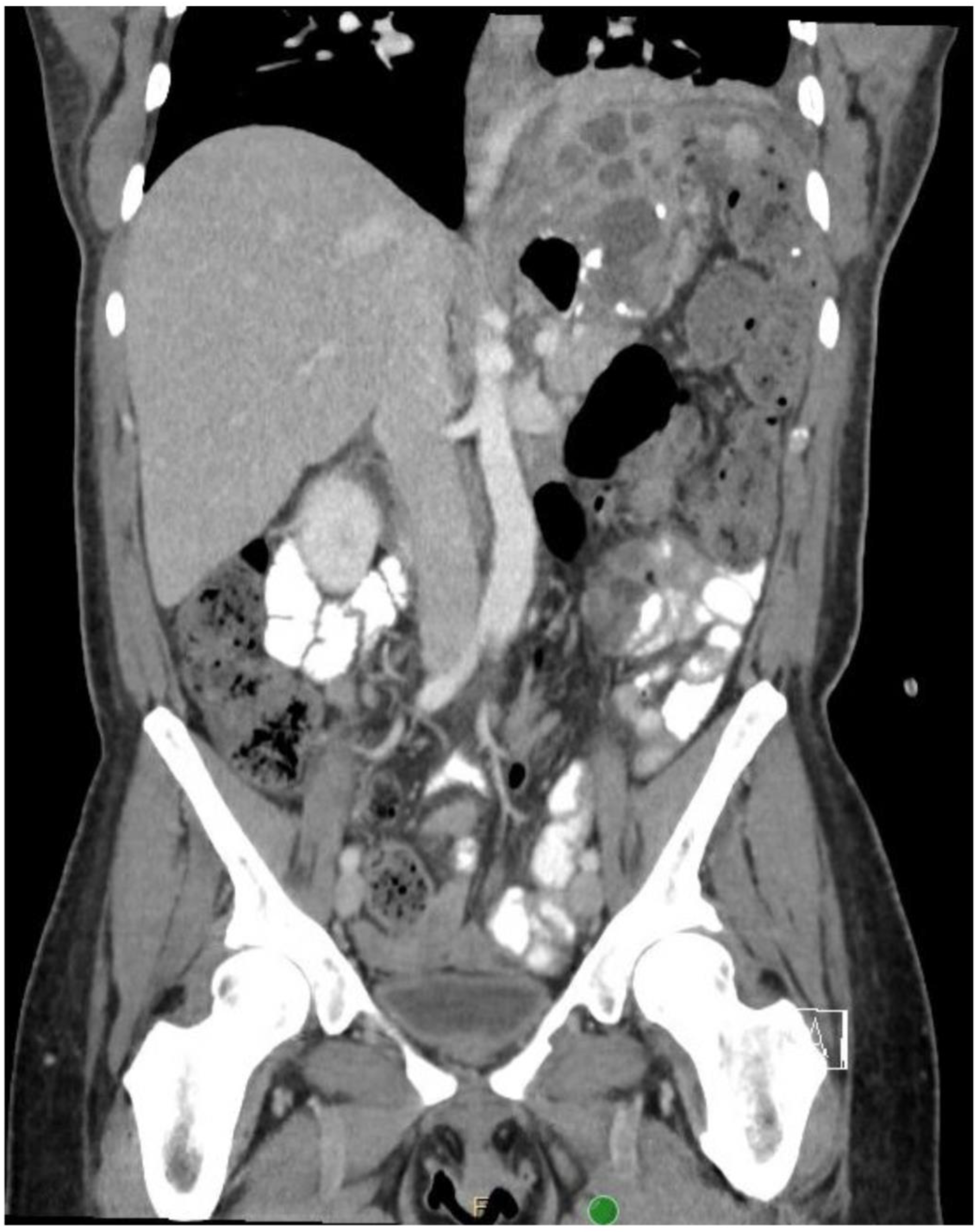 Jcm 11 07487 g003 Jcm 11 07487 g003