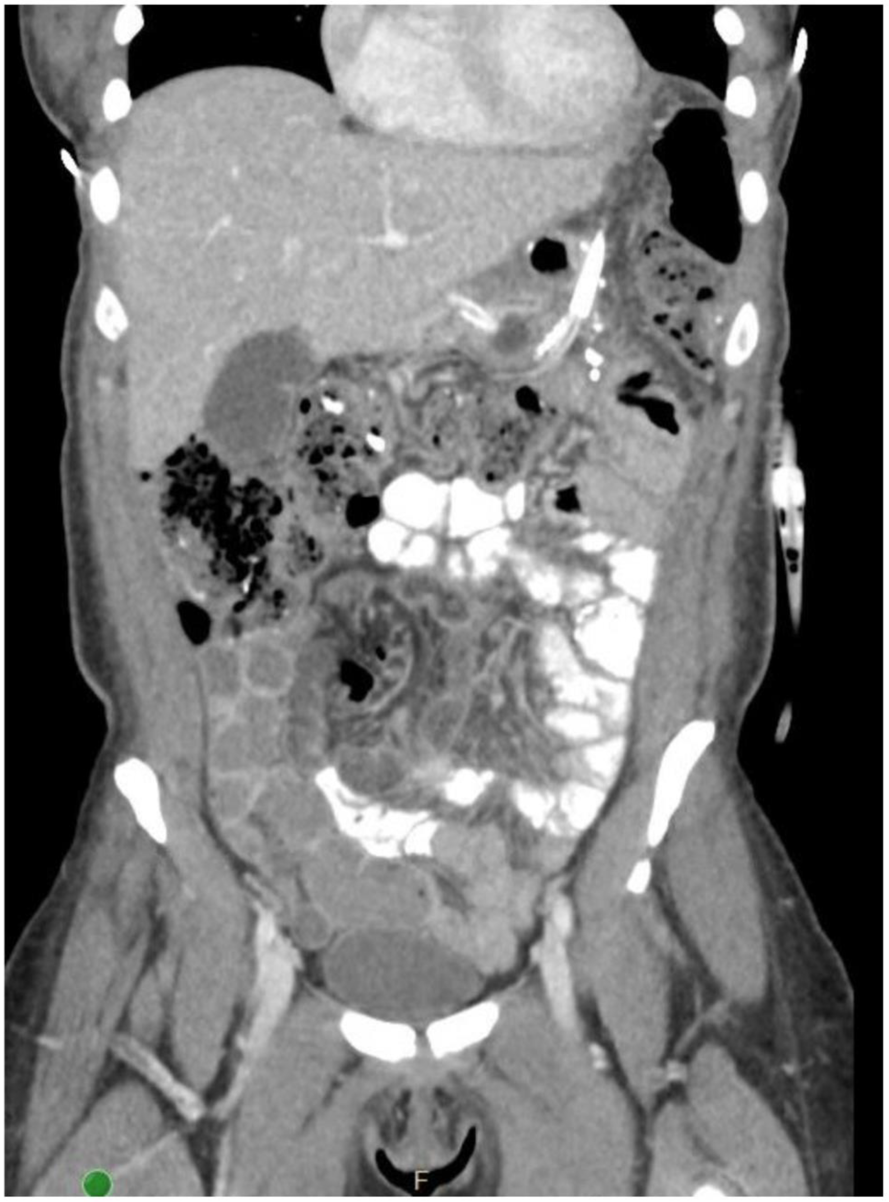 Jcm 11 07487 g004 Jcm 11 07487 g004