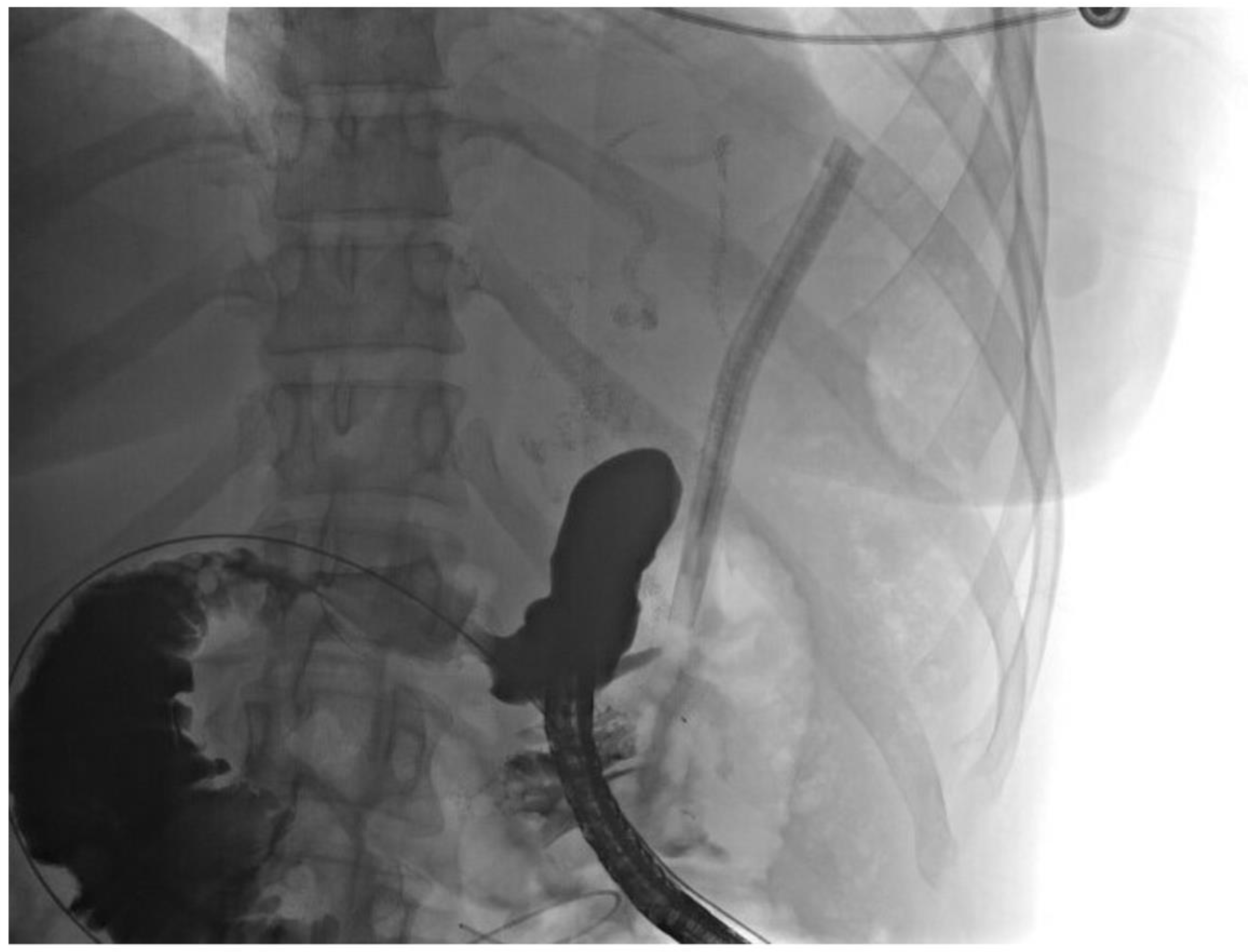 Jcm 11 07487 g006 Jcm 11 07487 g006