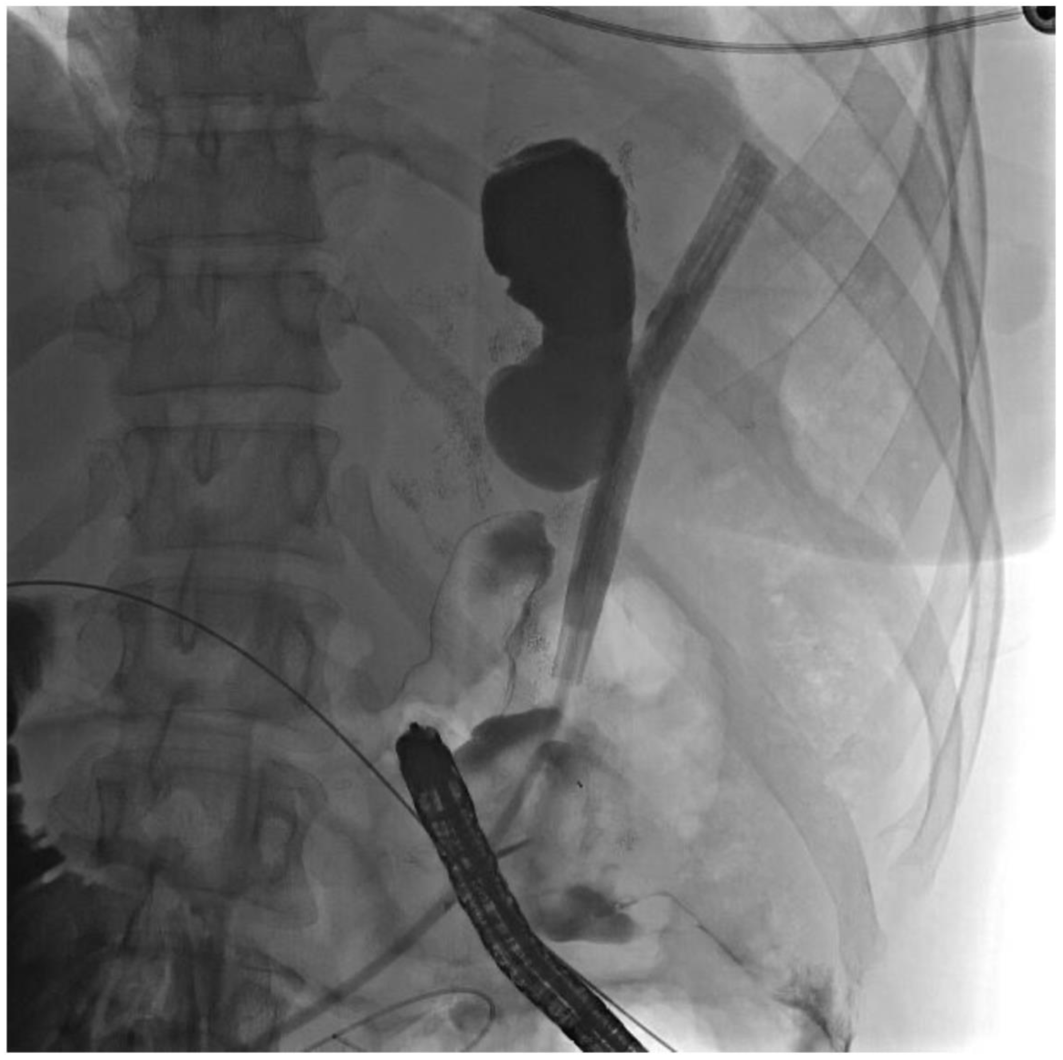 Jcm 11 07487 g008 Jcm 11 07487 g008