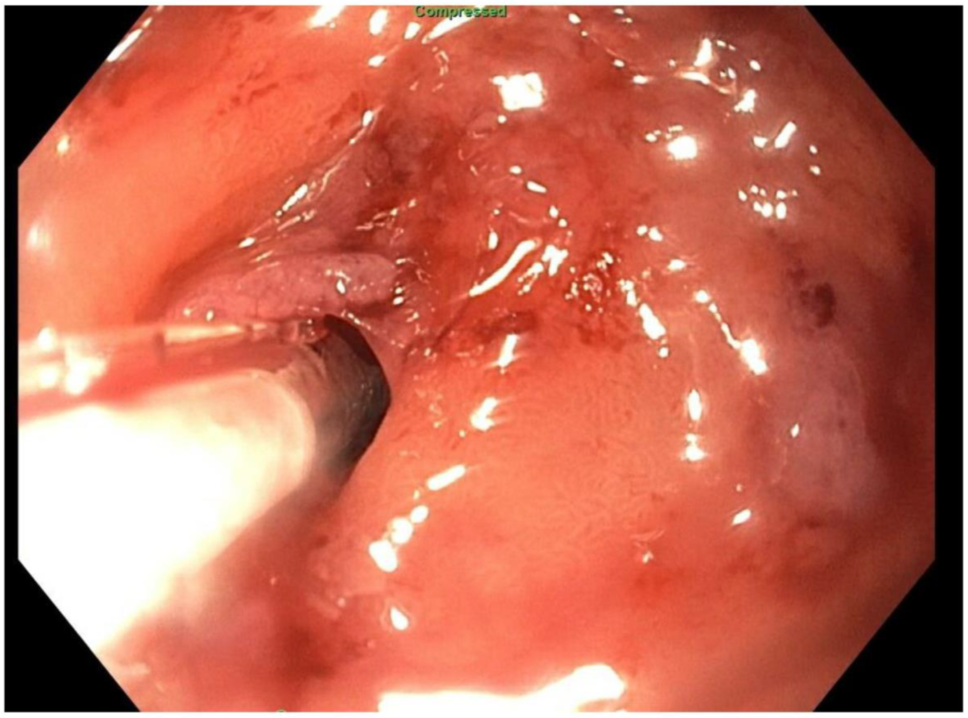 Jcm 11 07487 g013 Jcm 11 07487 g013