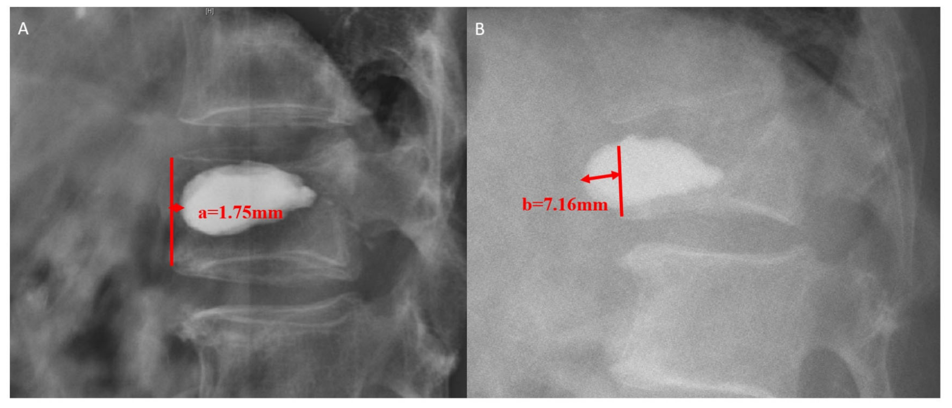JCM Free FullText Incidence, Risk Factors, and of