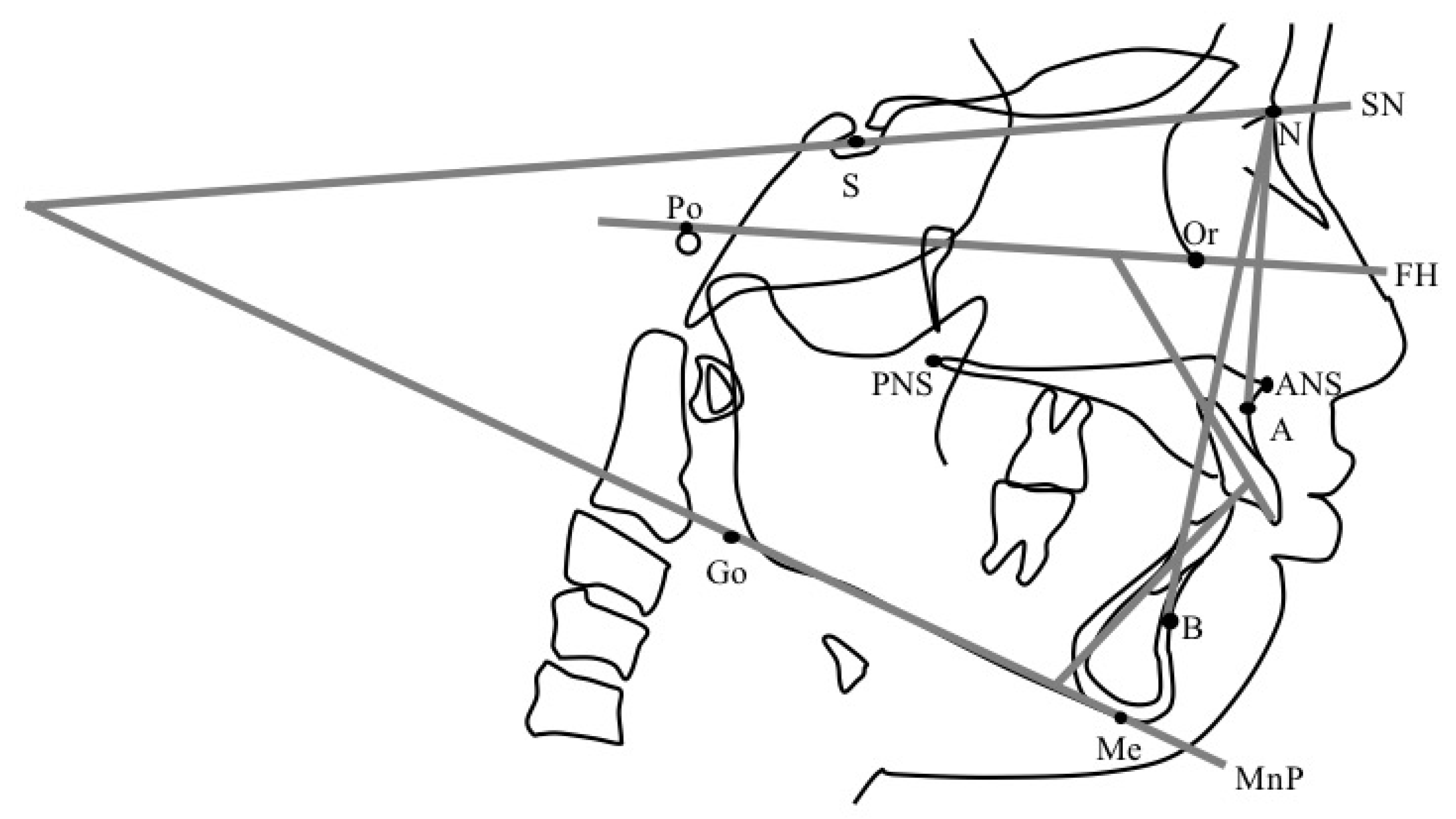 Jcm 11 07539 g004 Jcm 11 07539 g004