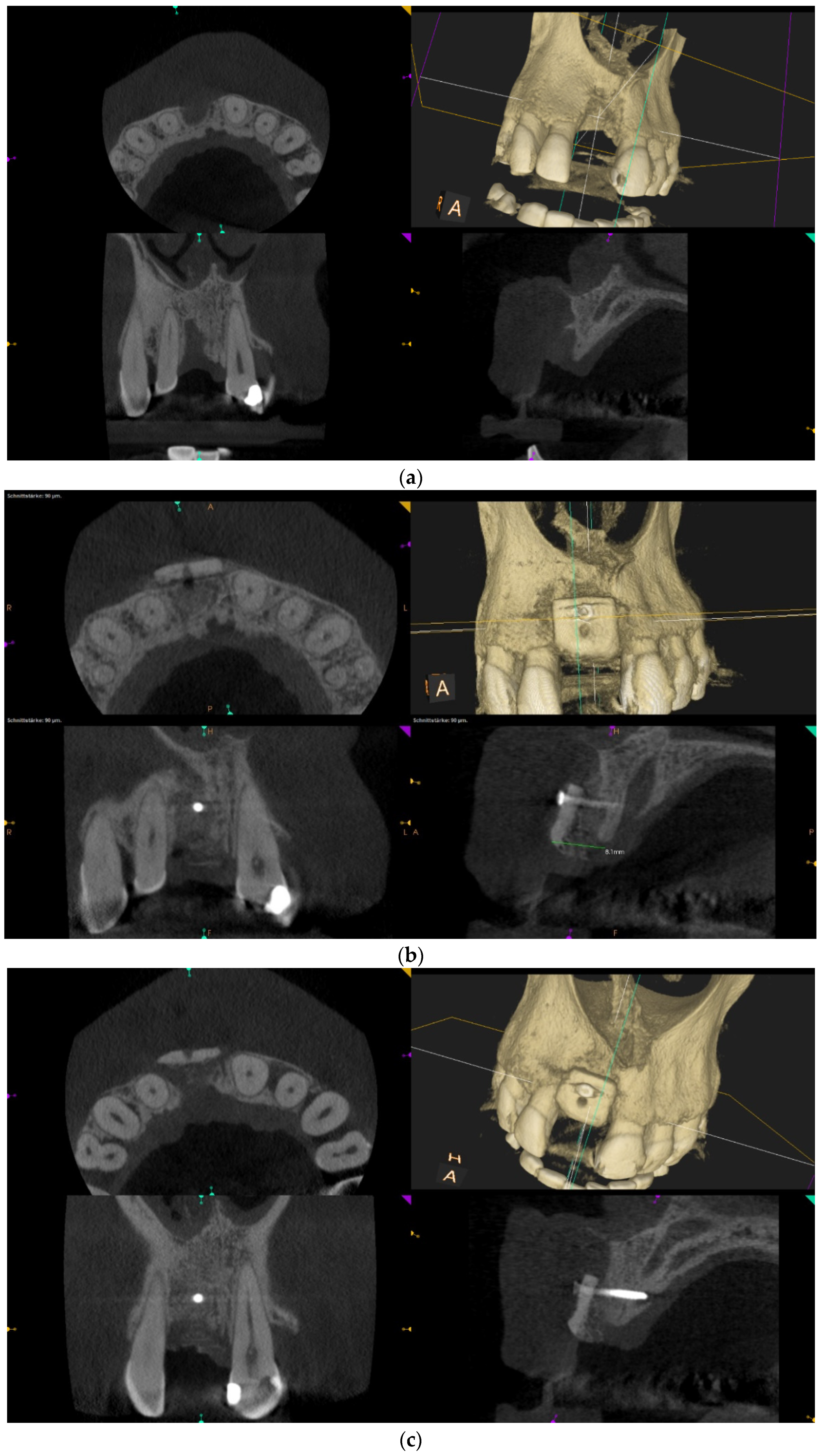 Jcm 12 00006 g002a Jcm 12 00006 g002a