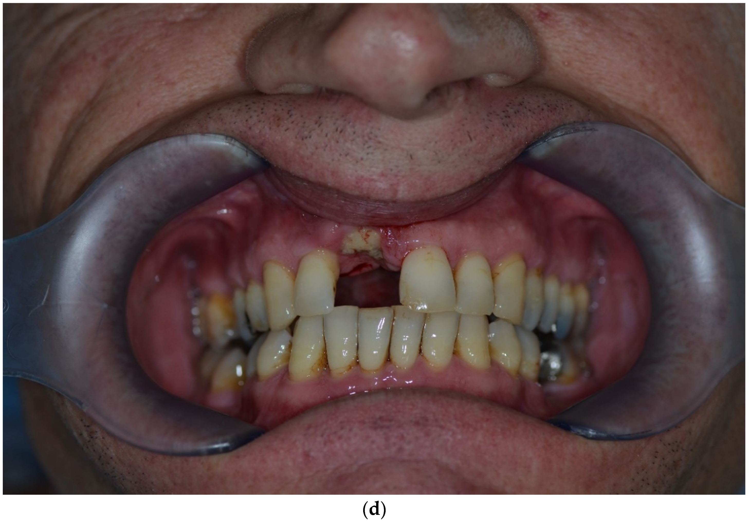 Jcm 12 00006 g002b Jcm 12 00006 g002b