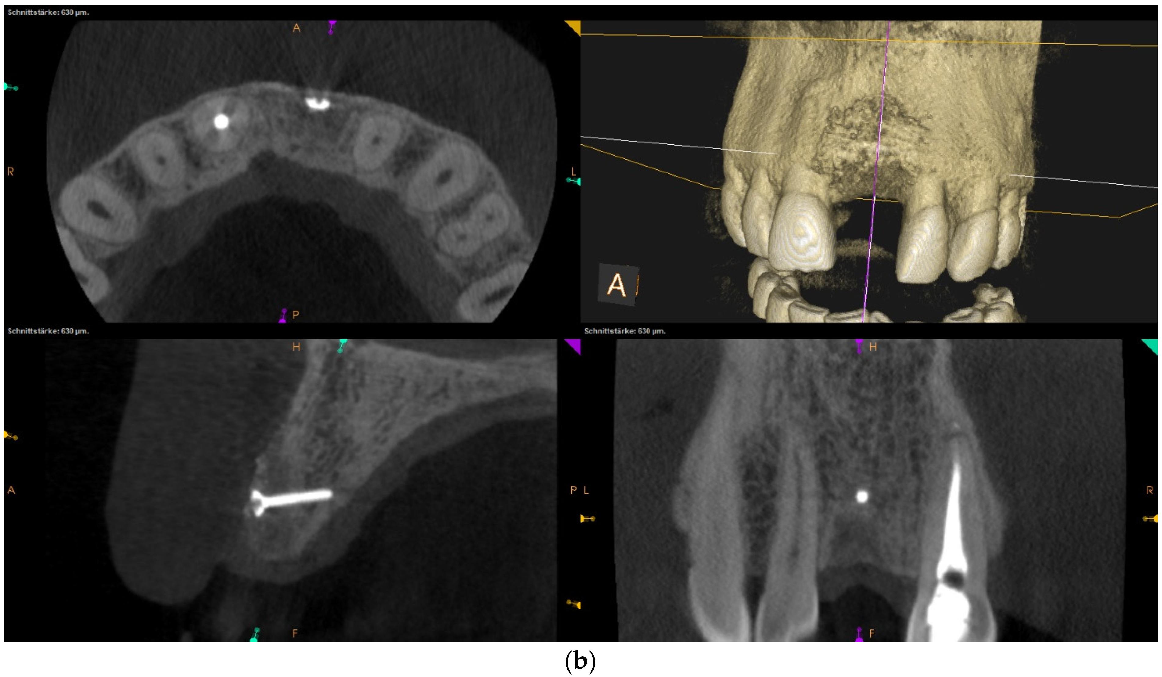 Shocking Findings: The Hidden Secrets Of External Oblique Ridge Radiographs - gwnes8z