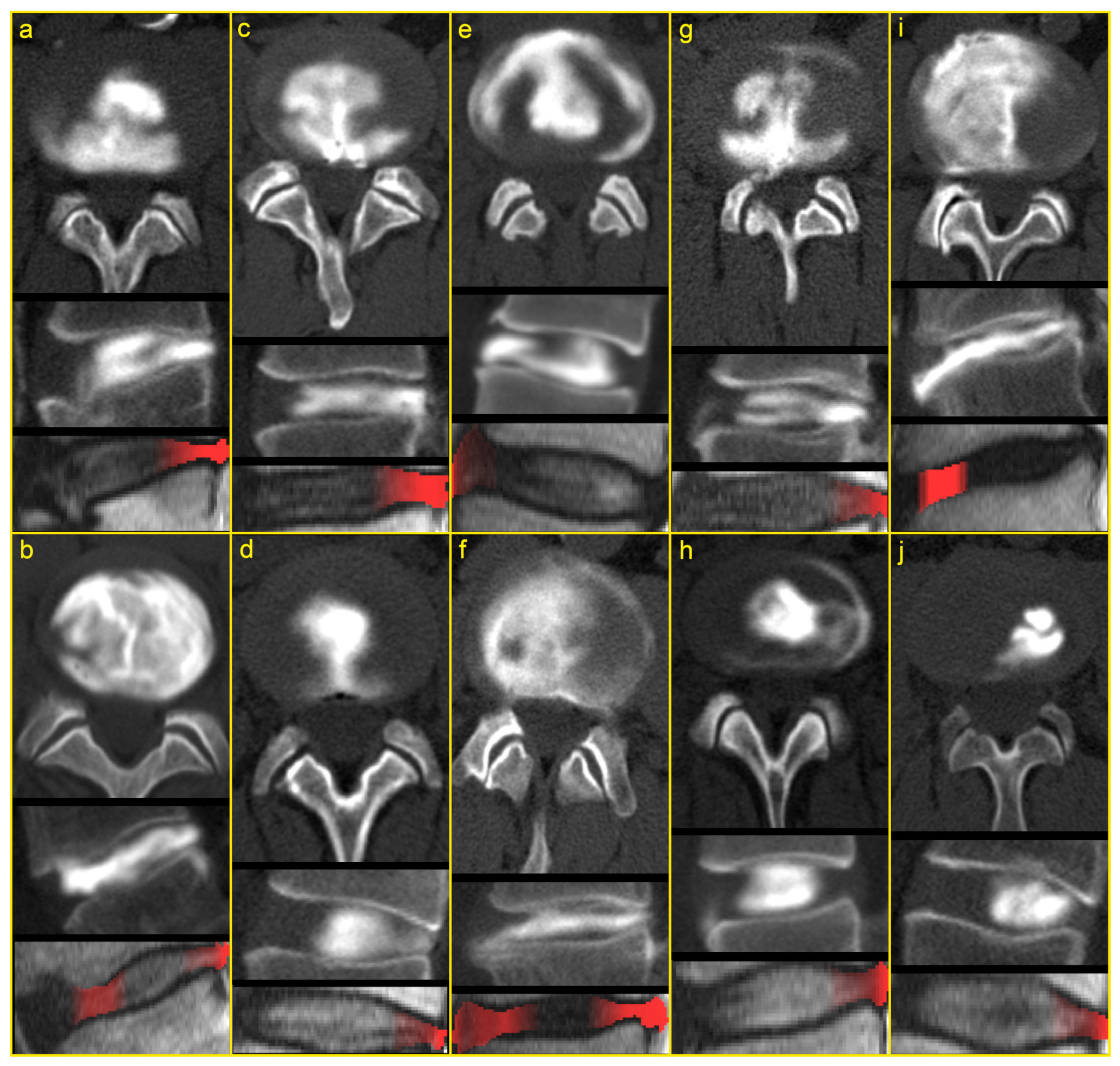 Jcm 12 00011 g004 Jcm 12 00011 g004