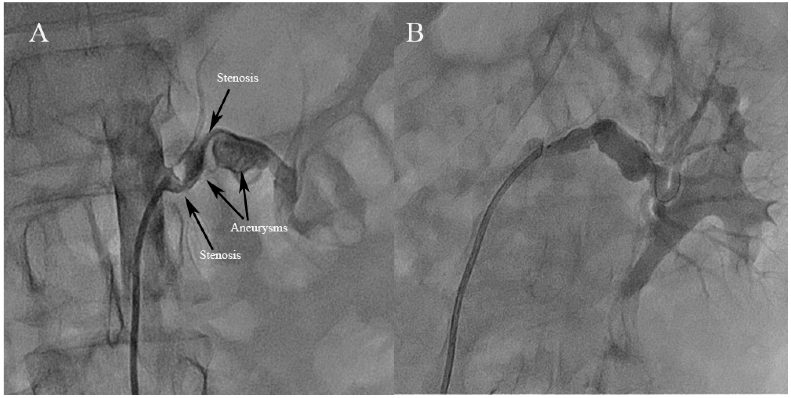 Jcm 12 00023 g002 Jcm 12 00023 g002