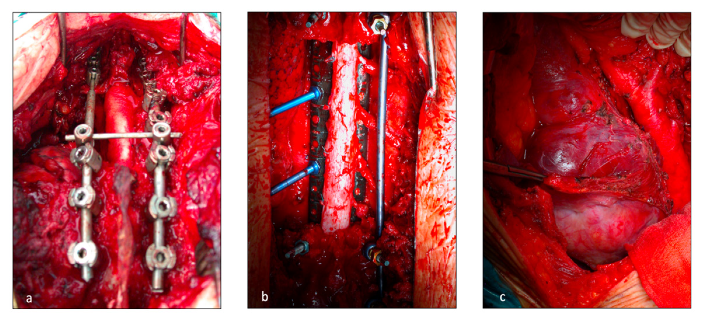 Jcm 12 00031 g001 Jcm 12 00031 g001