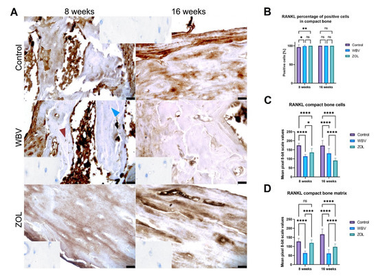 Effect of Mechanical Stimuli and Zoledronic Acid on the