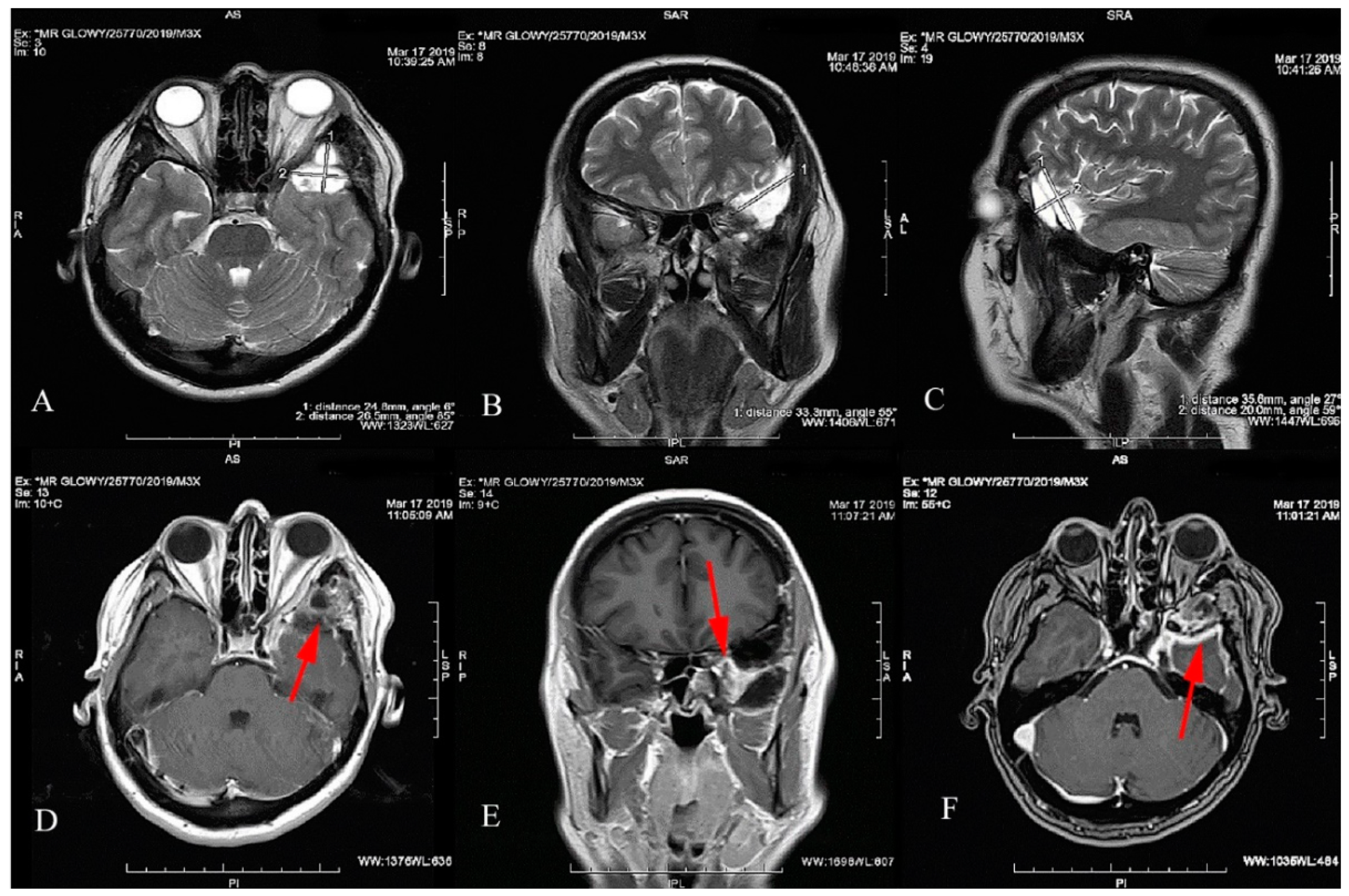 Jcm 12 00074 g003 Jcm 12 00074 g003