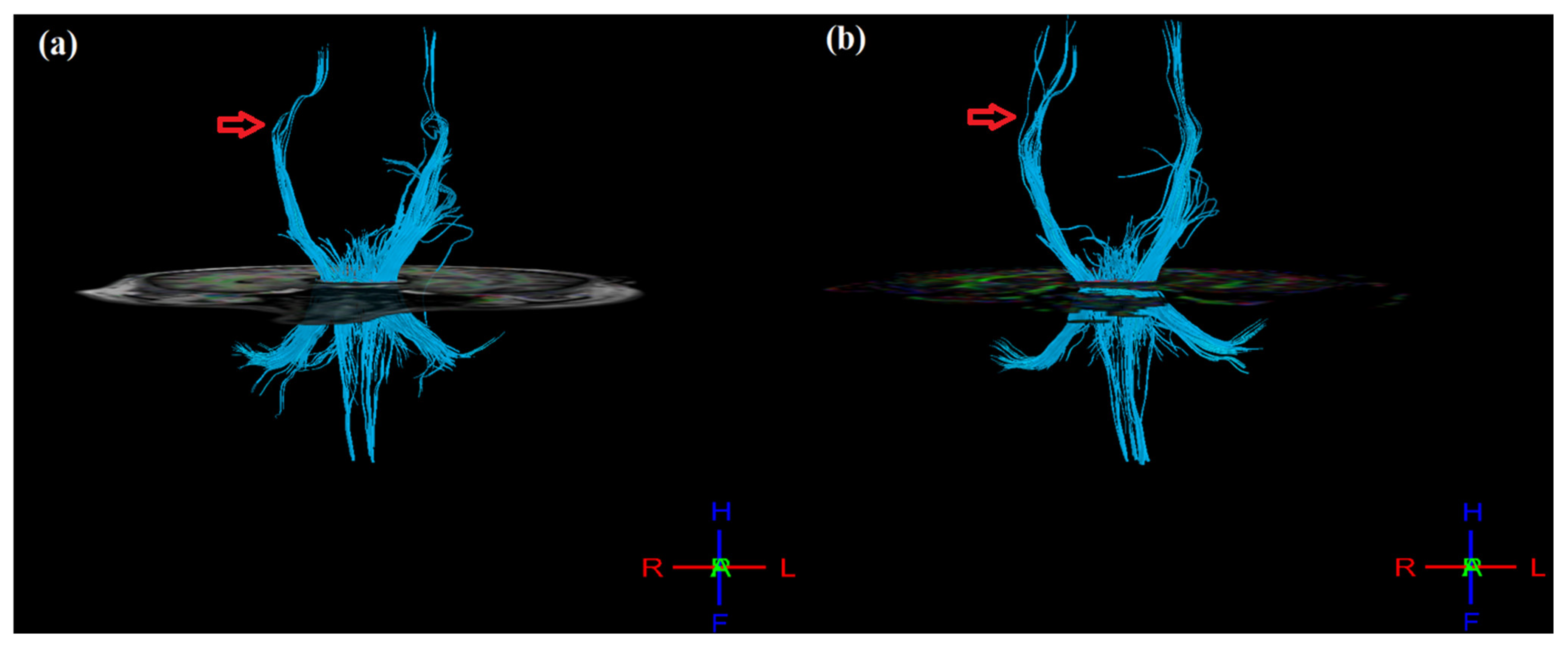 Jcm 12 00092 g004 Jcm 12 00092 g004
